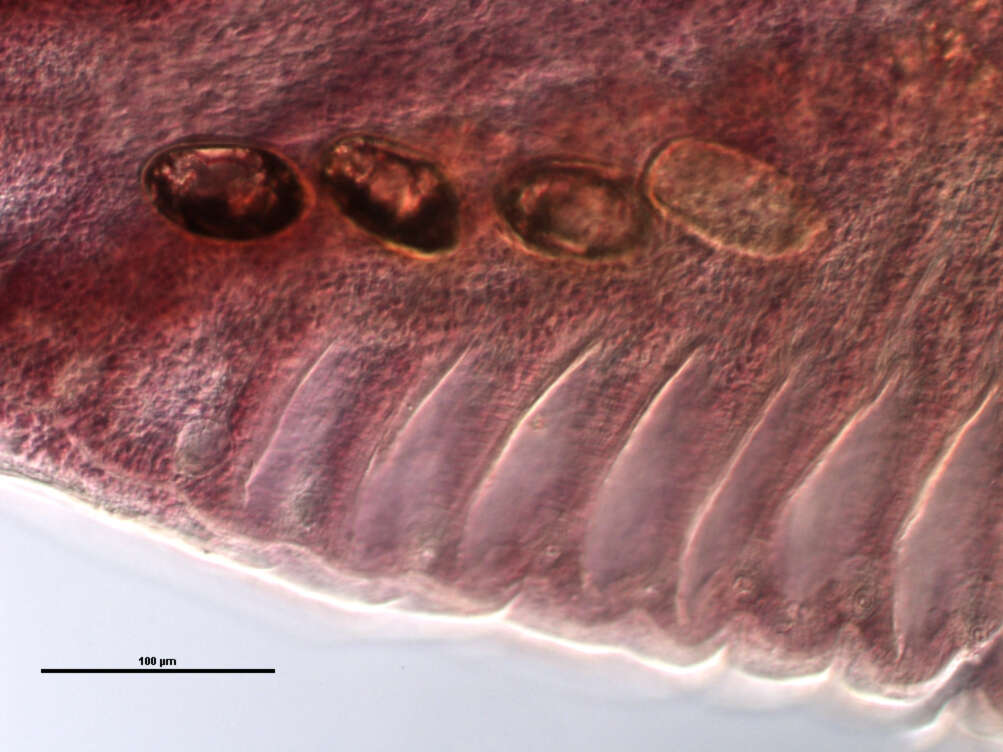 Слика од Lobatostoma ringens (Linton 1905) Eckmann 1932