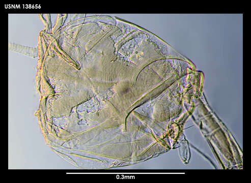 Image of Philomedes cubitum Kornicker 1975