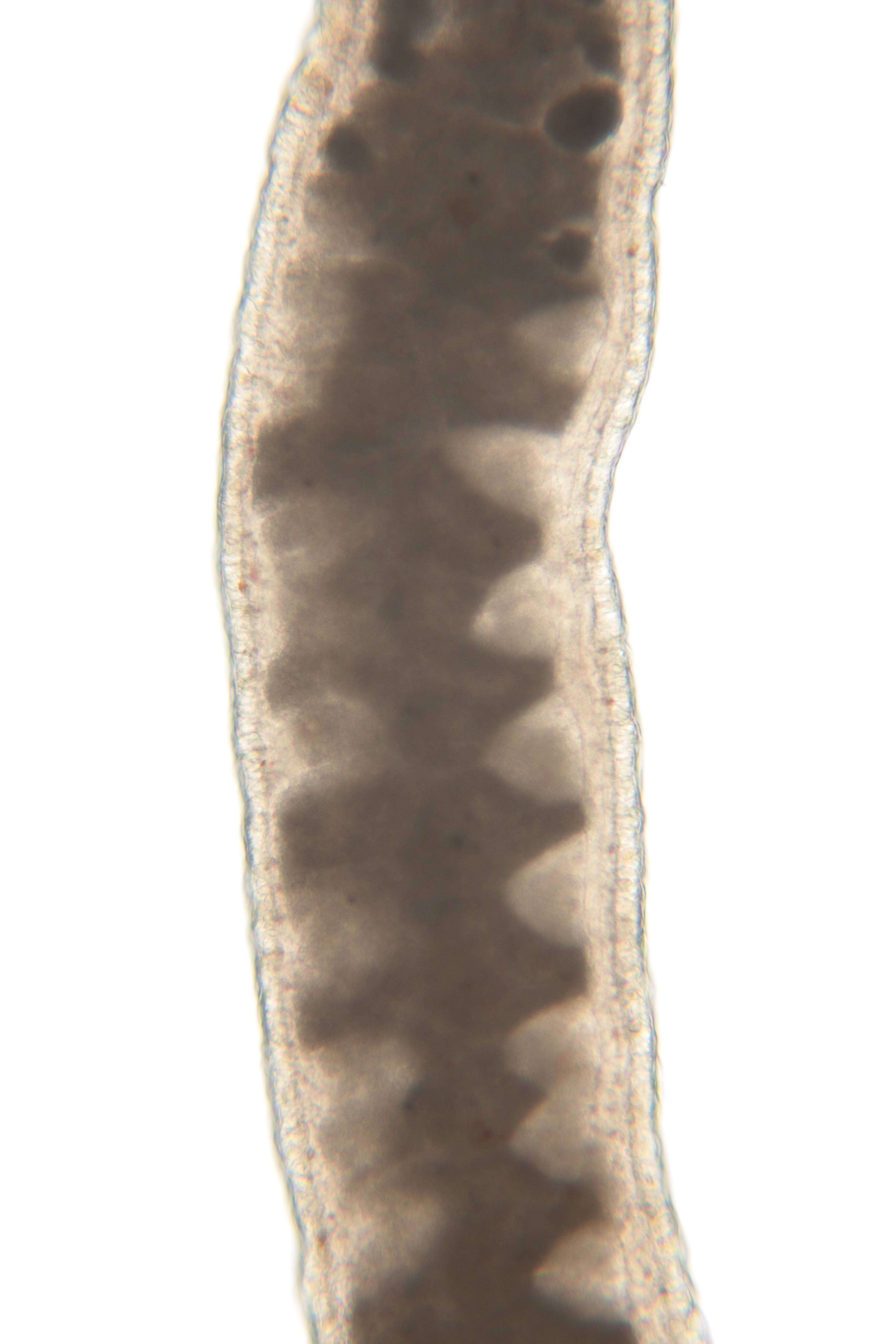 Image of Ototyphlonemertes (Duplex) duplex Bürger 1895