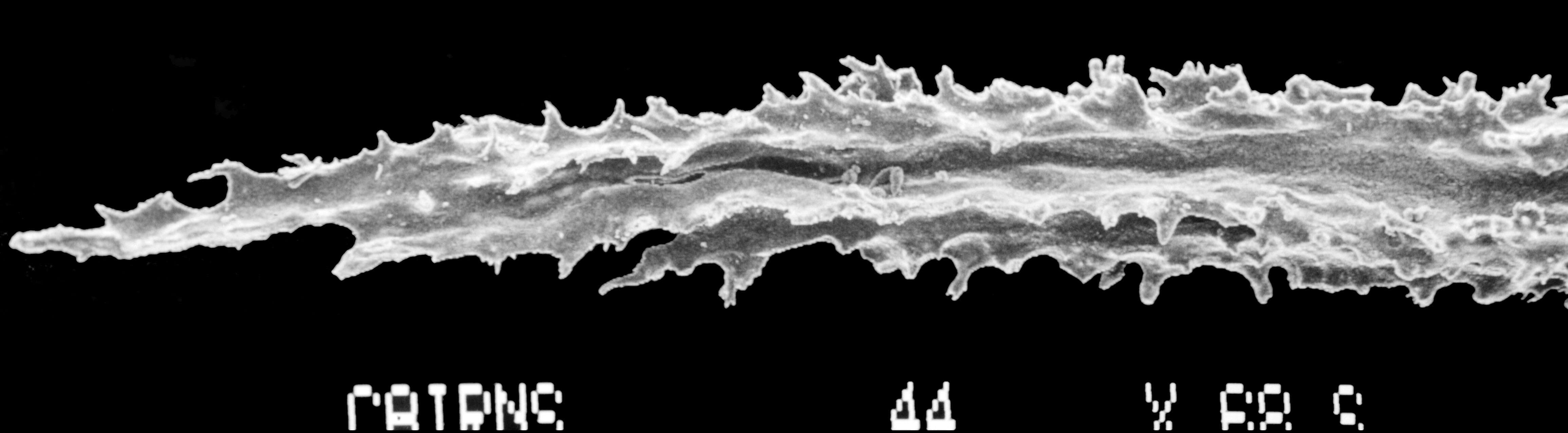 Image of Sporadopora dichotoma (Moseley 1876)