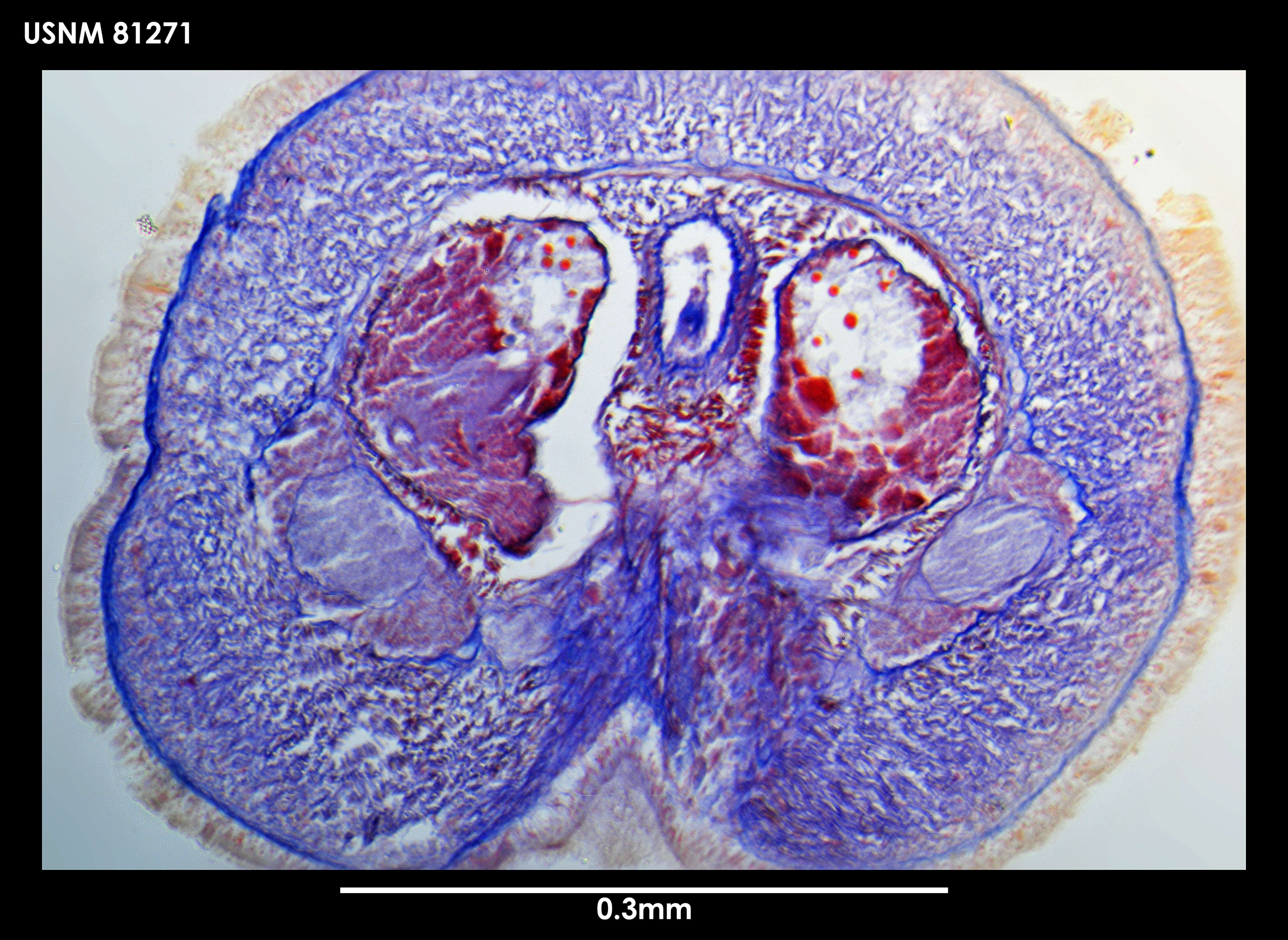 Image of Paramicrurinella falklandica Gibson 1985