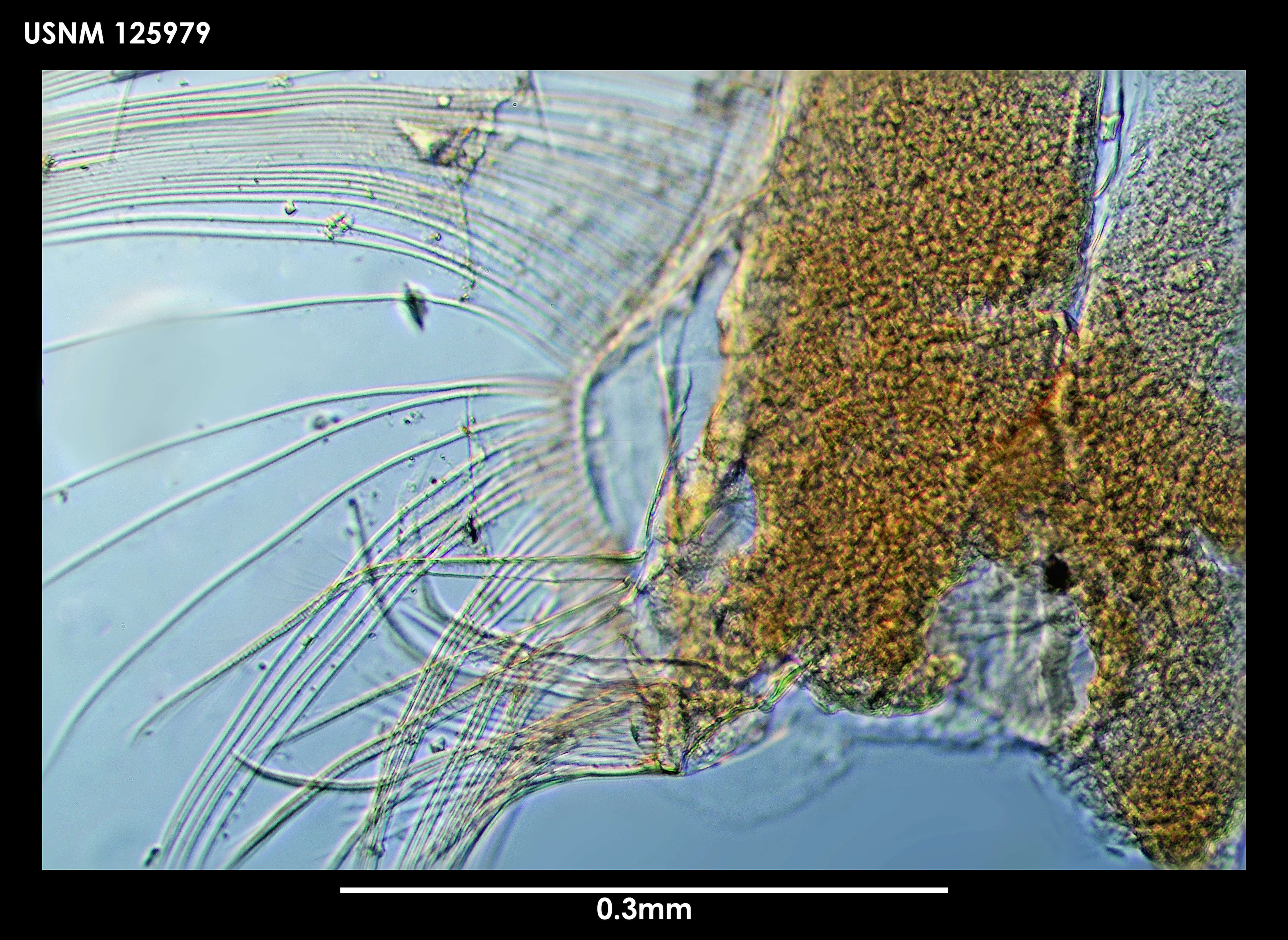 Image de Diasterope schmitti Kornicker 1975