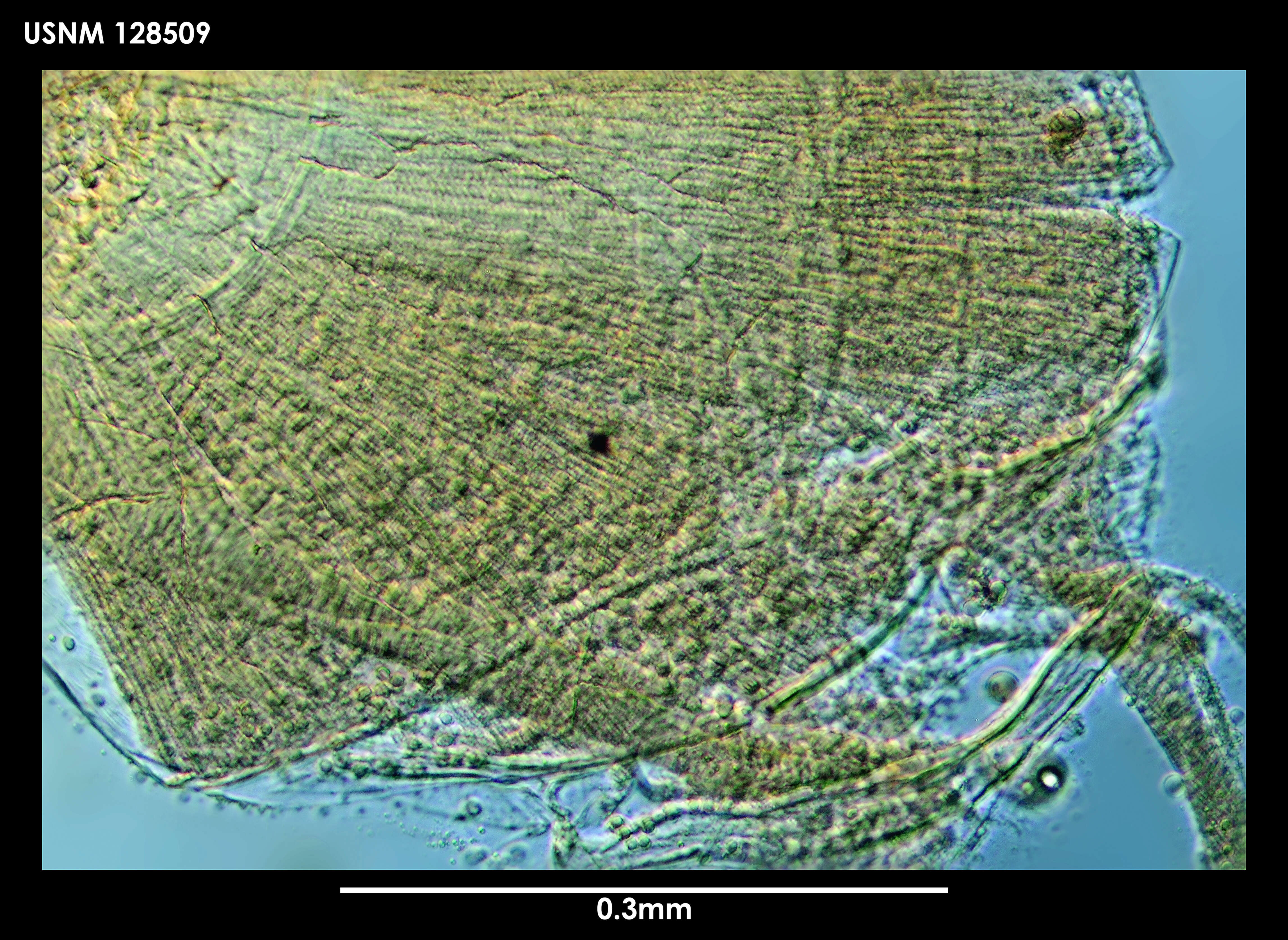 Image de Synasterope polythrix Kornicker 1975