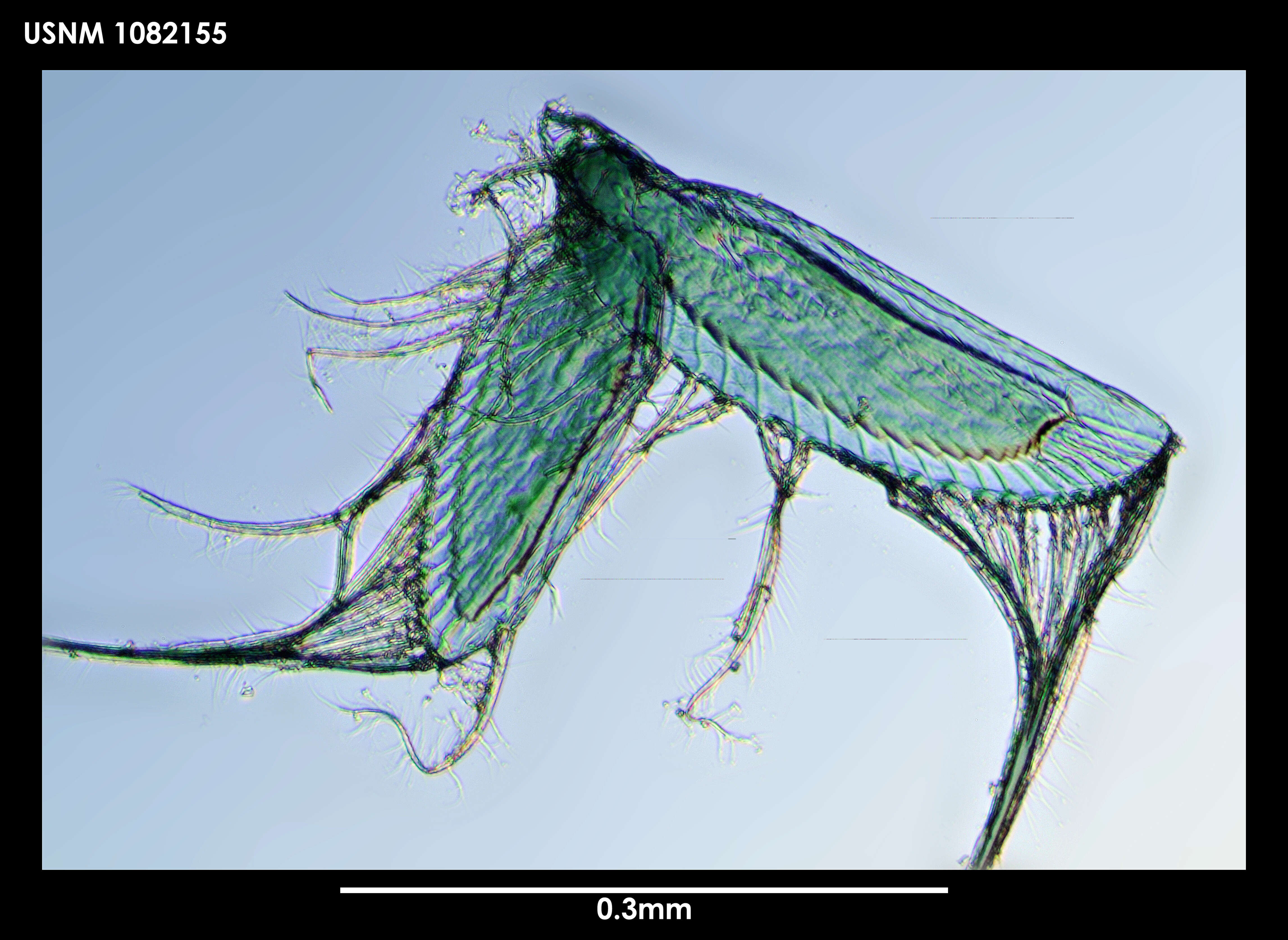 Imagem de Peraeospinosus subtigaleatus Blazewicz-Paszkowycz 2005