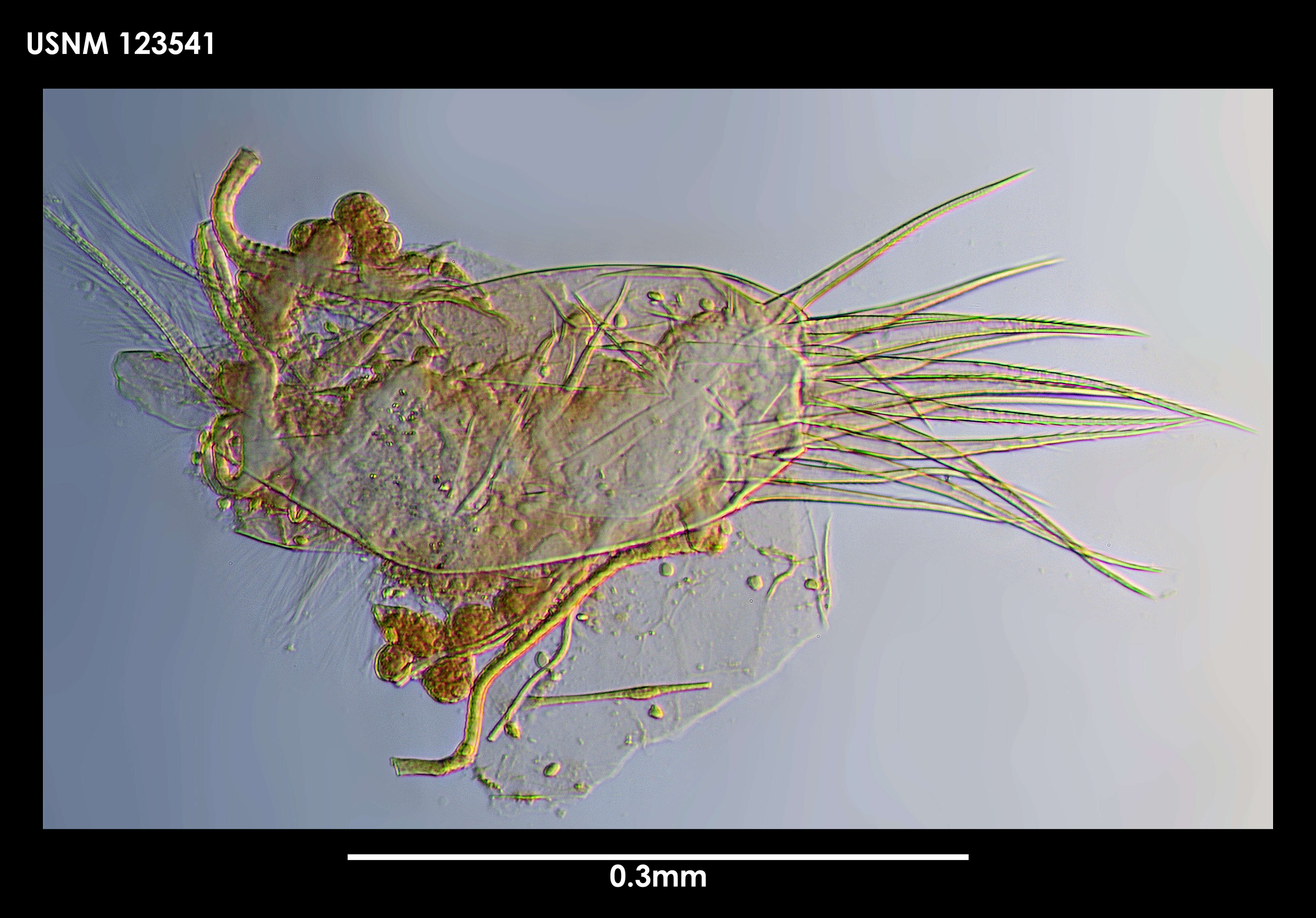 Image de Spinacopia octo Kornicker 1970