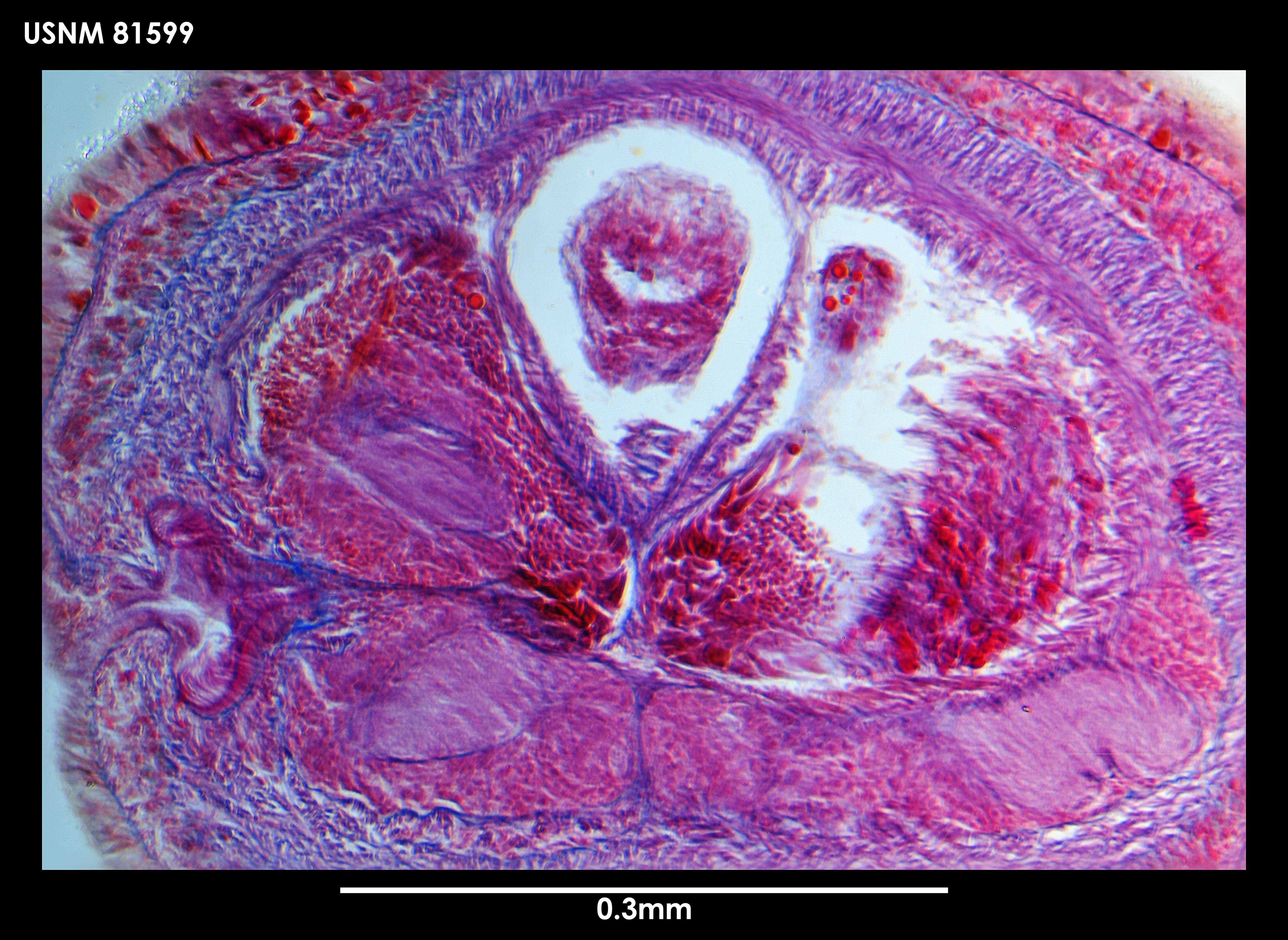 Image of Zodionemertes chilensis Gibson 1985