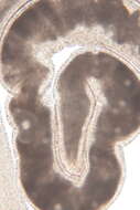 Image of Ototyphlonemertes (Duplex) duplex Bürger 1895