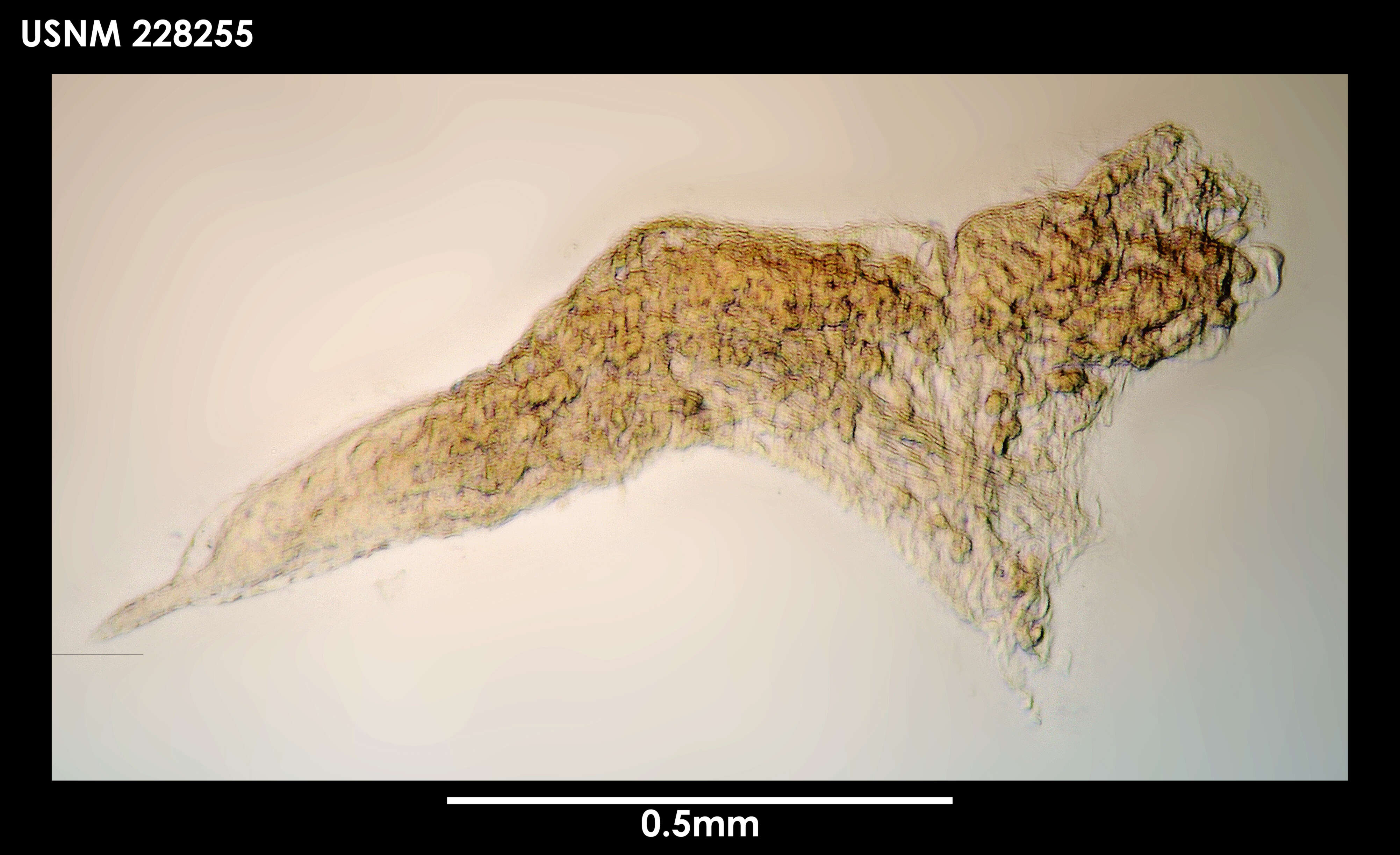 Image de Gongylophysema asetosum Grygier 1987