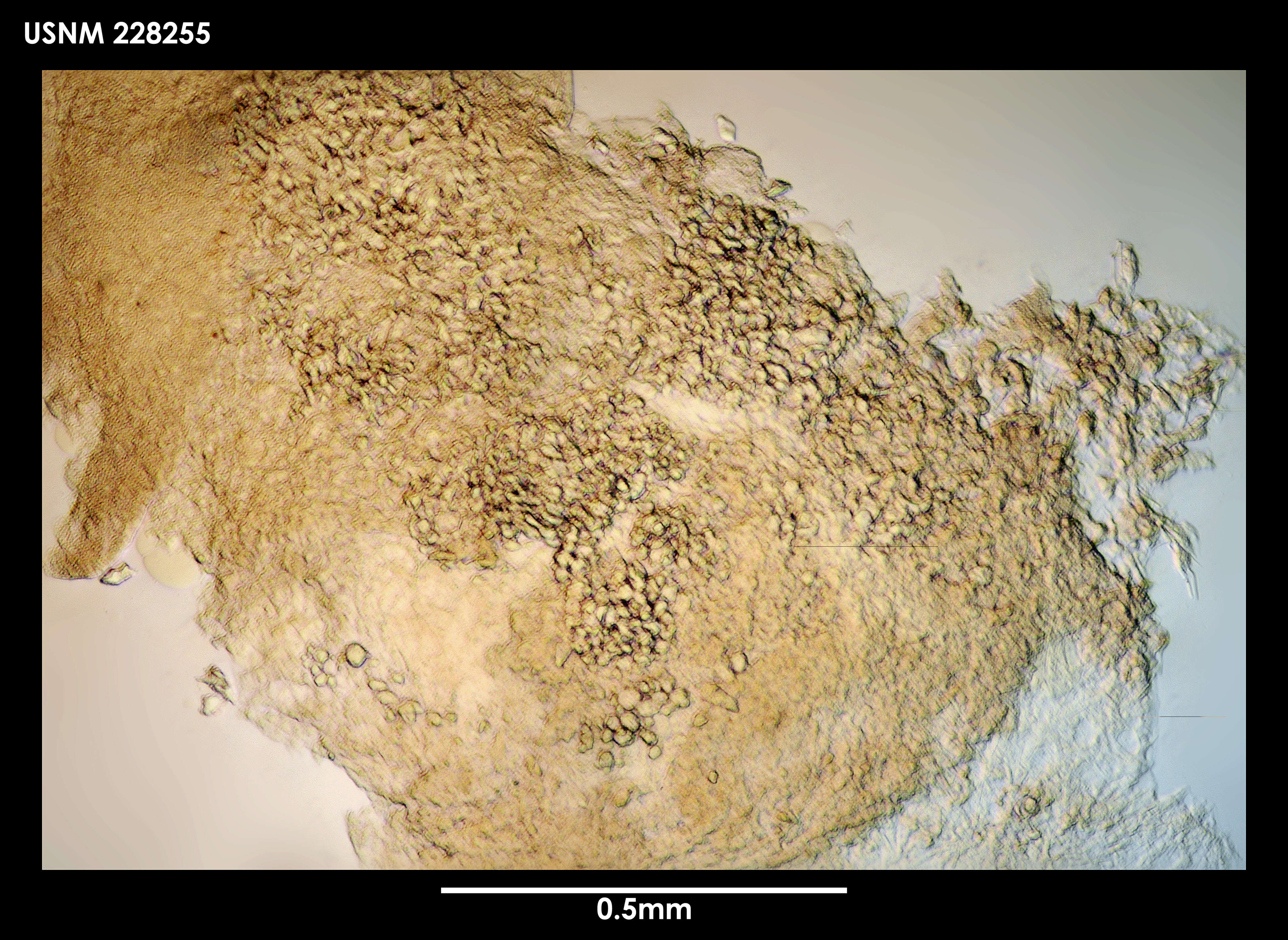 Image de Gongylophysema asetosum Grygier 1987