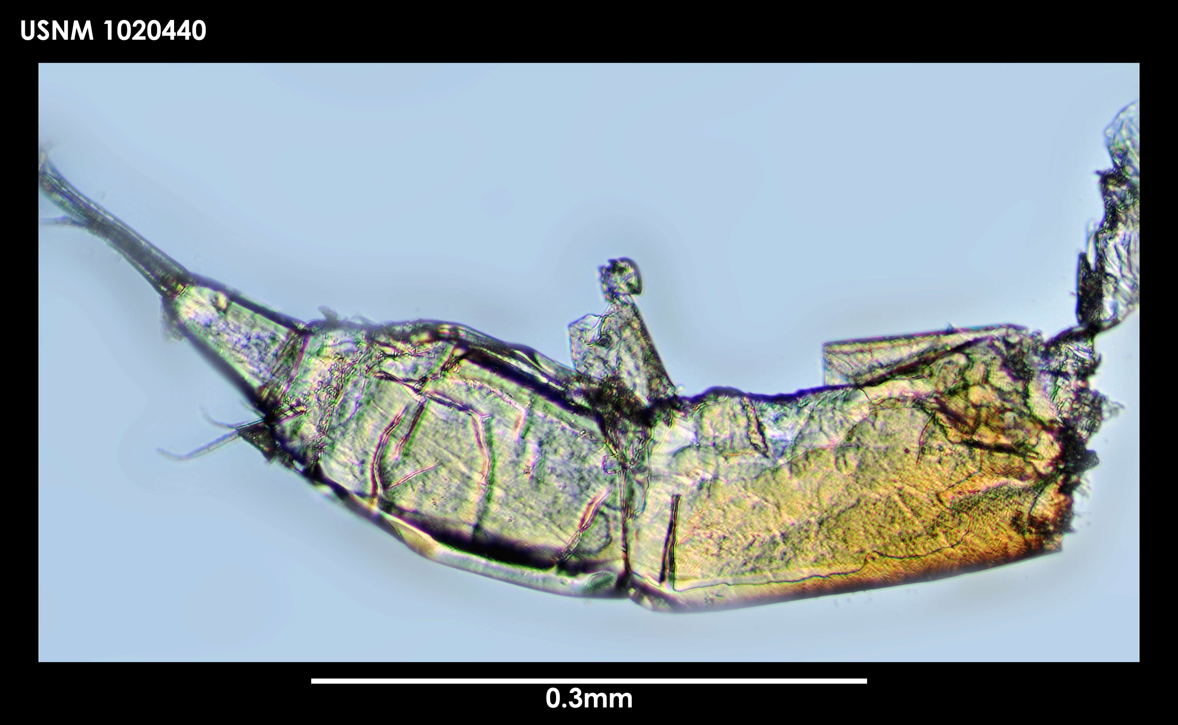 Image of Tanaella eltaninae Guerrero-Kommritz & Blazewicz-Paszkowycz 2004