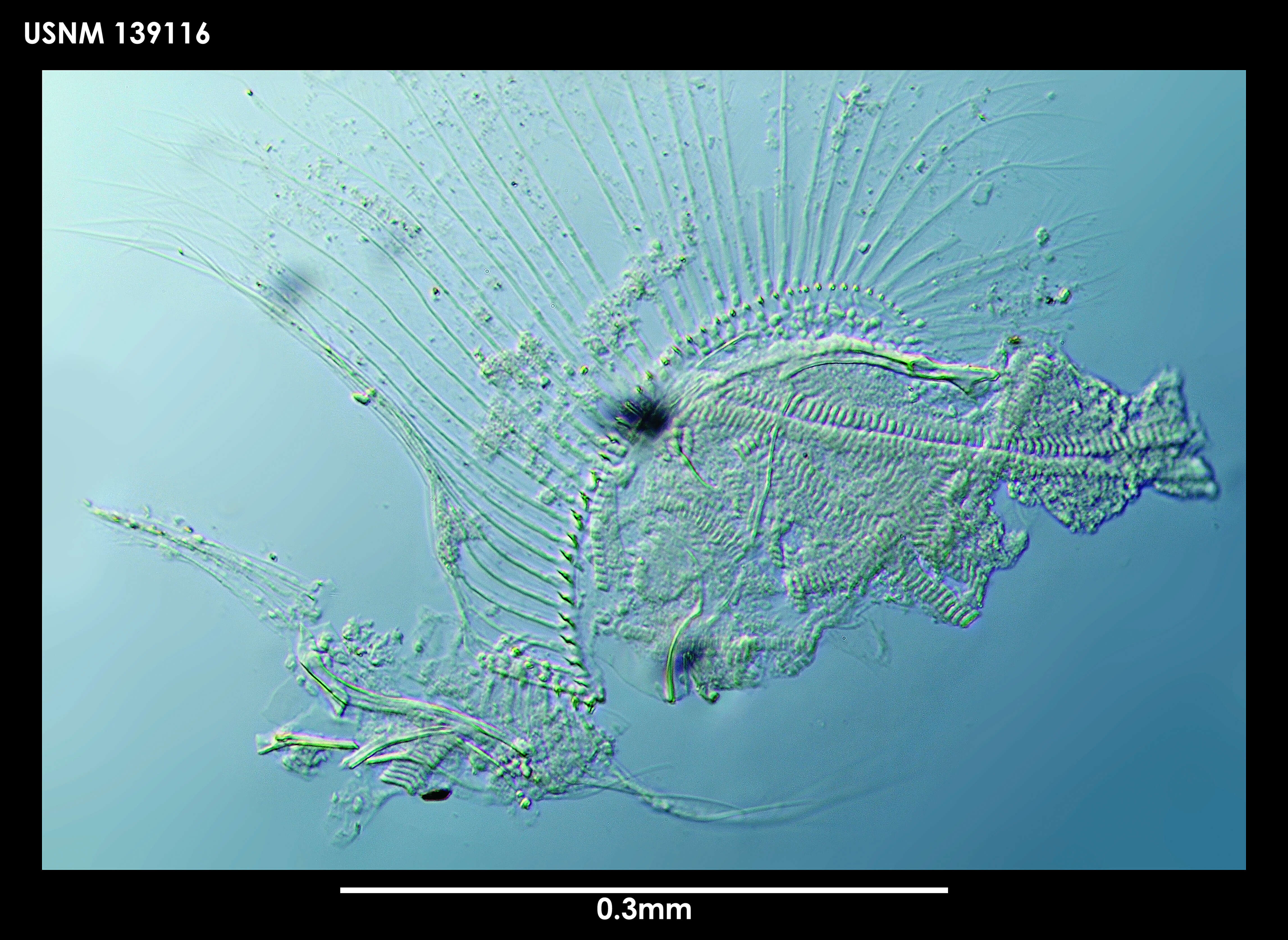 Image of Synasterope brachythrix Kornicker 1975