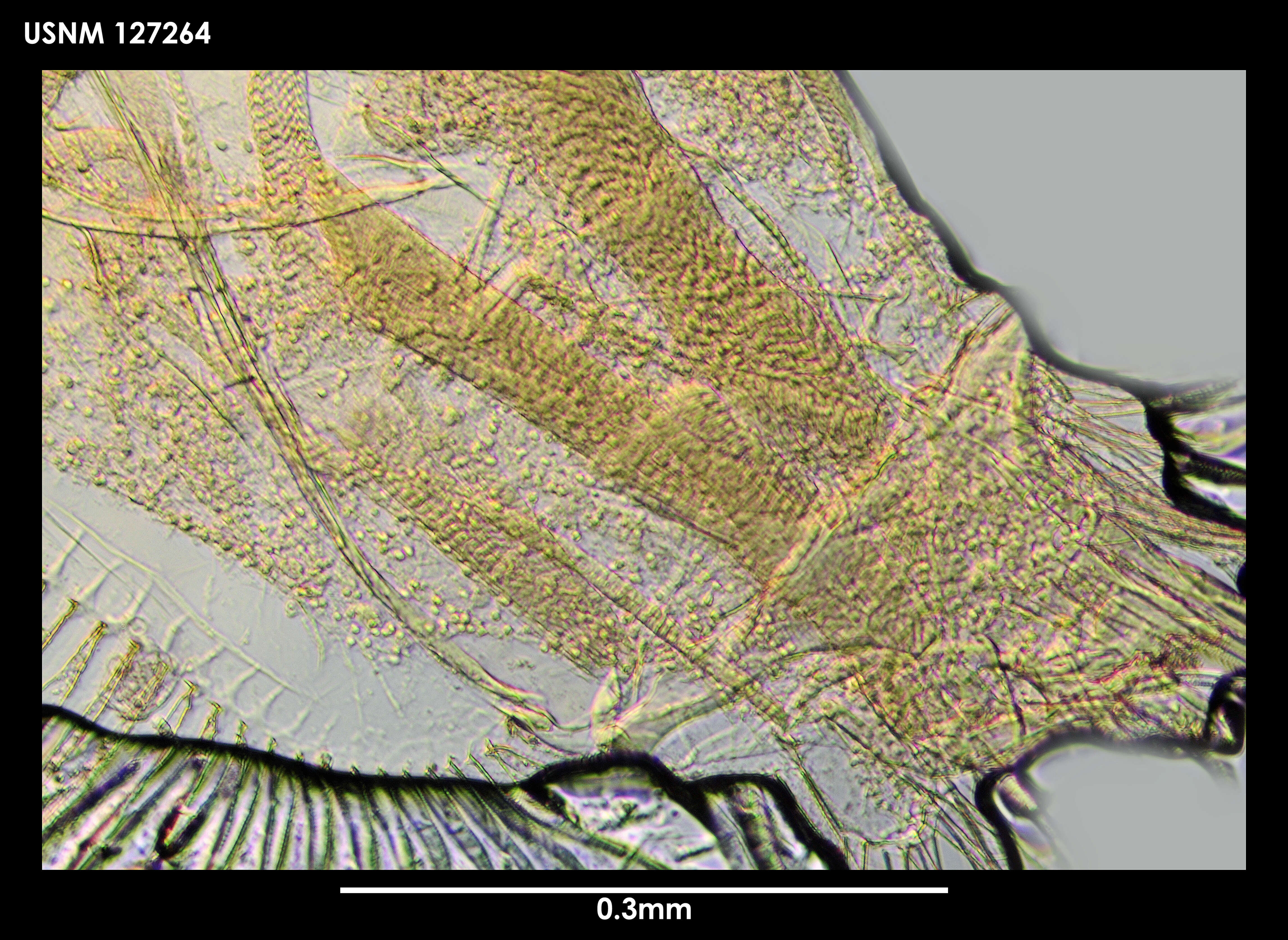 Image de Philomedes tetrathrix Kornicker 1975