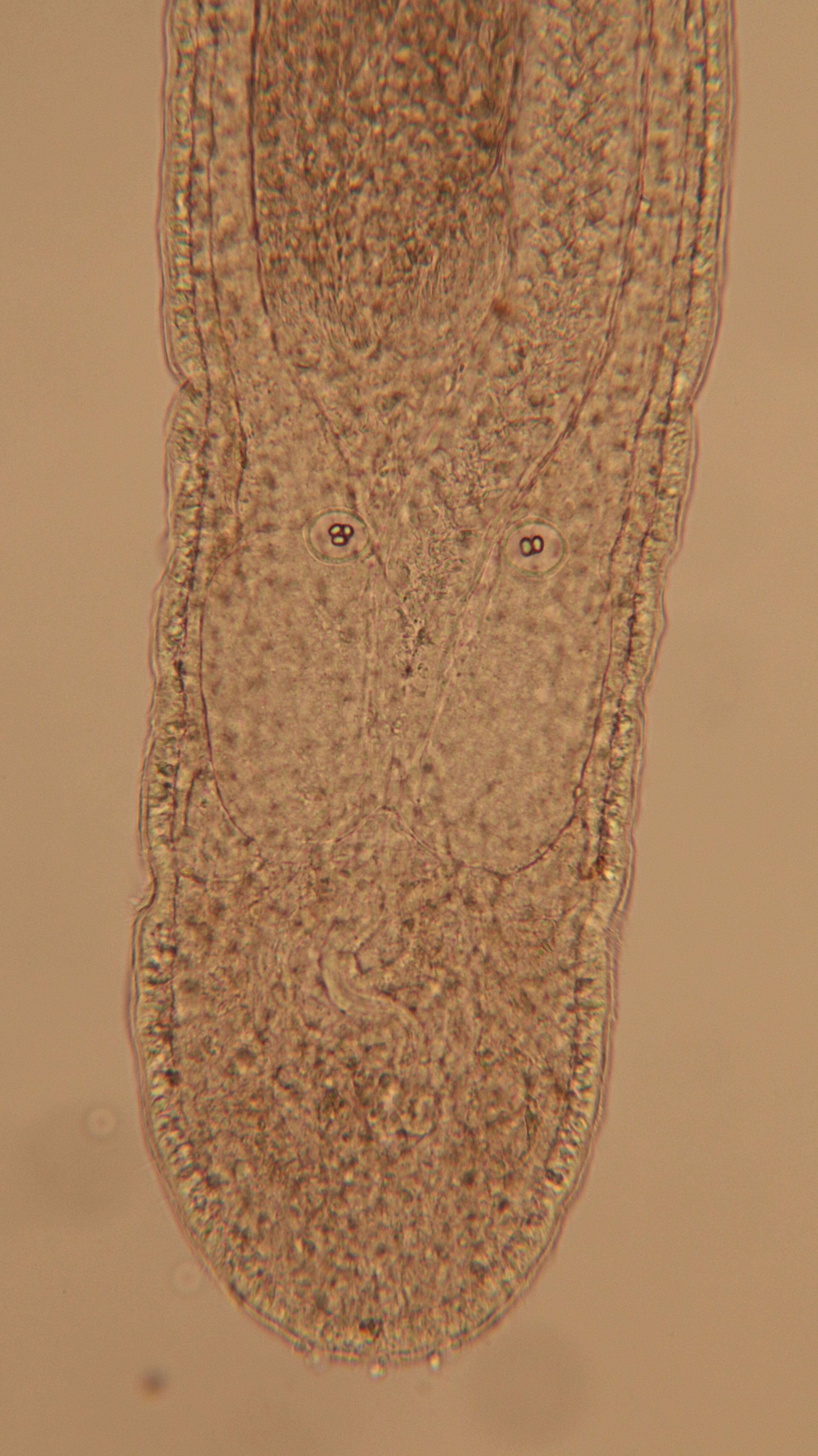 Image of Ototyphlonemertes (Duplex) duplex Bürger 1895