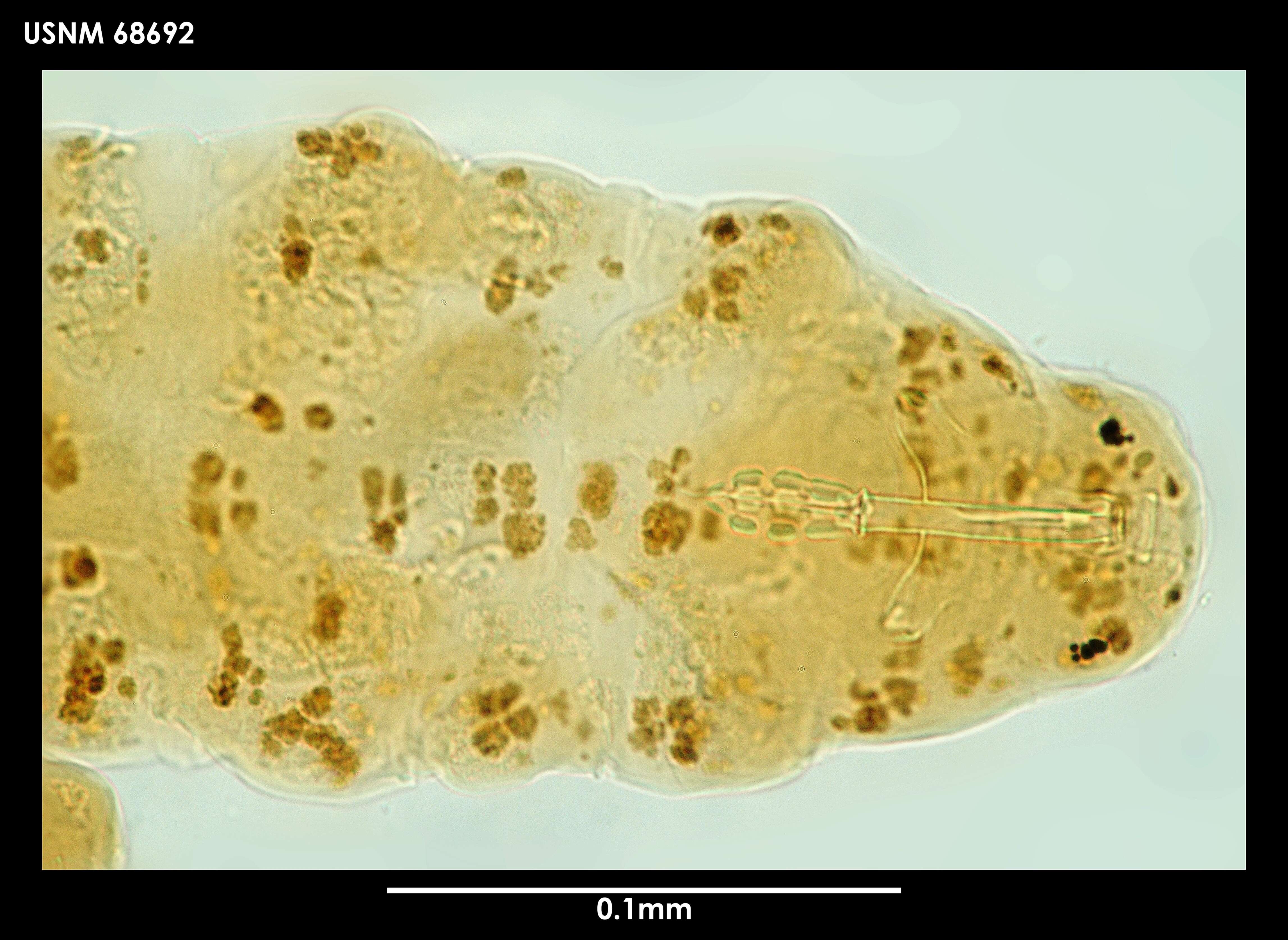 Image of Macrobiotus blocki Dastych 1984