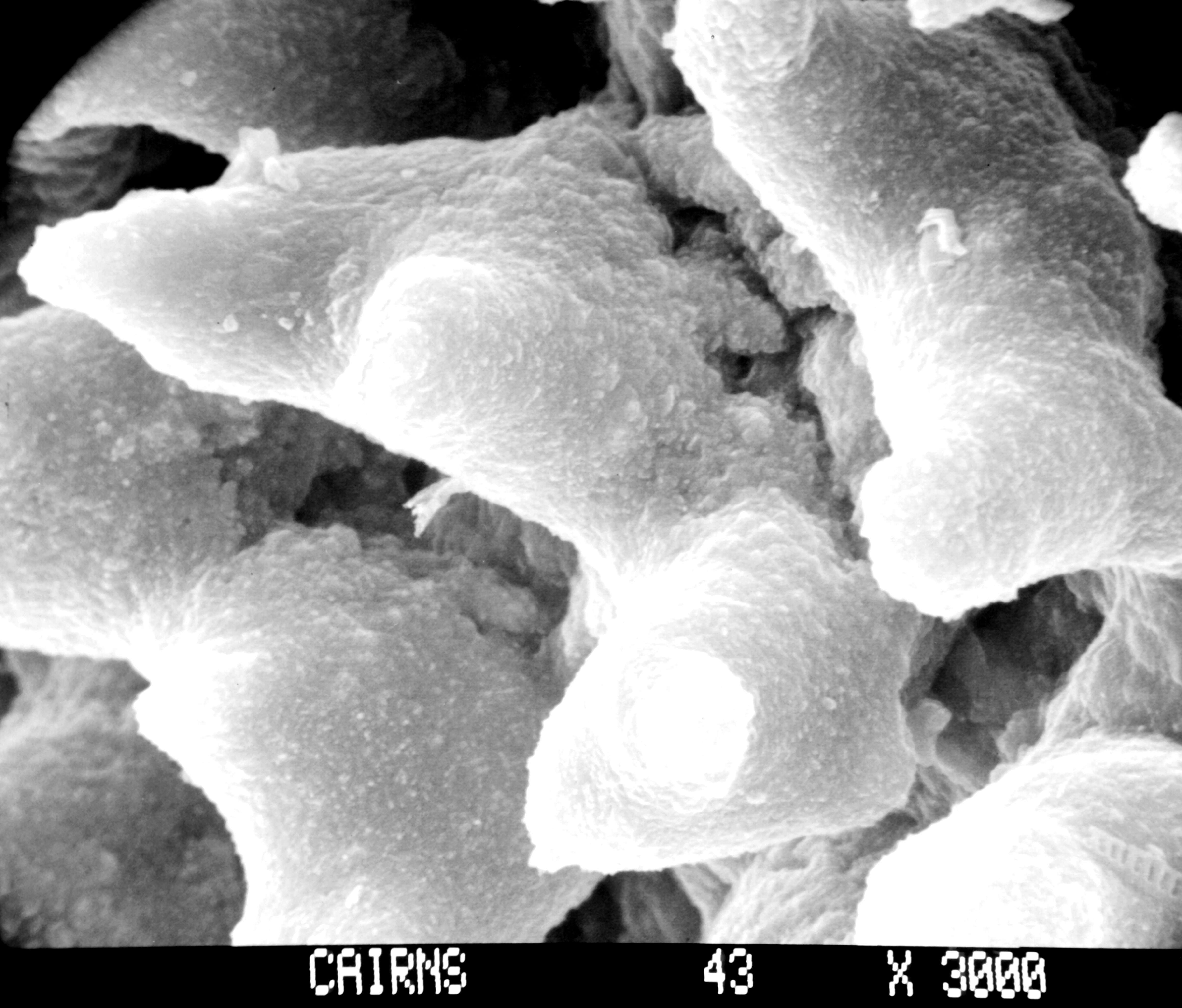 Image of Lepidopora acrolophos Cairns 1983