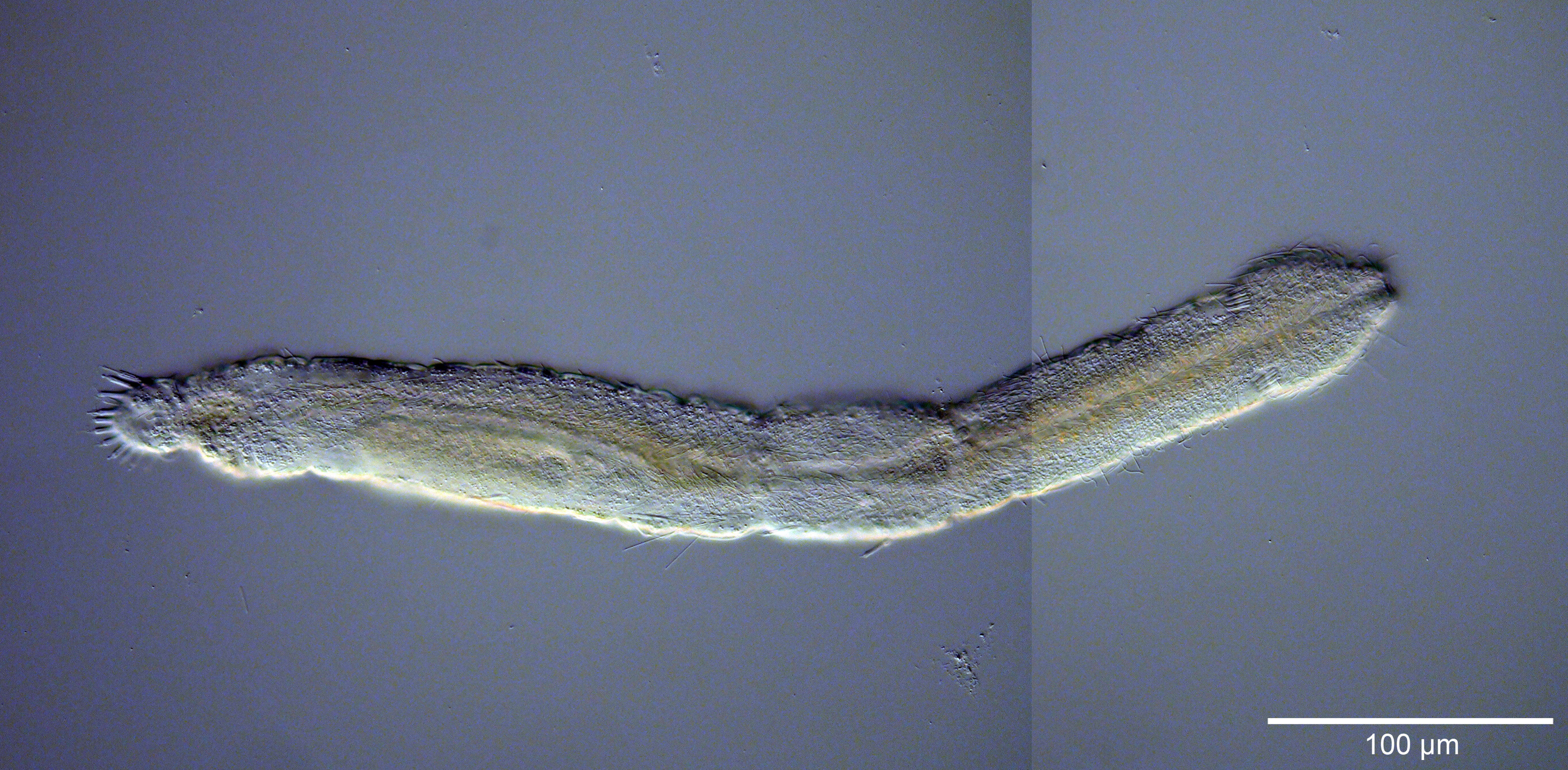 Image of Cephalodasys interinsularis Kieneke, Schmidt-Rhaesa & Hochberg 2015