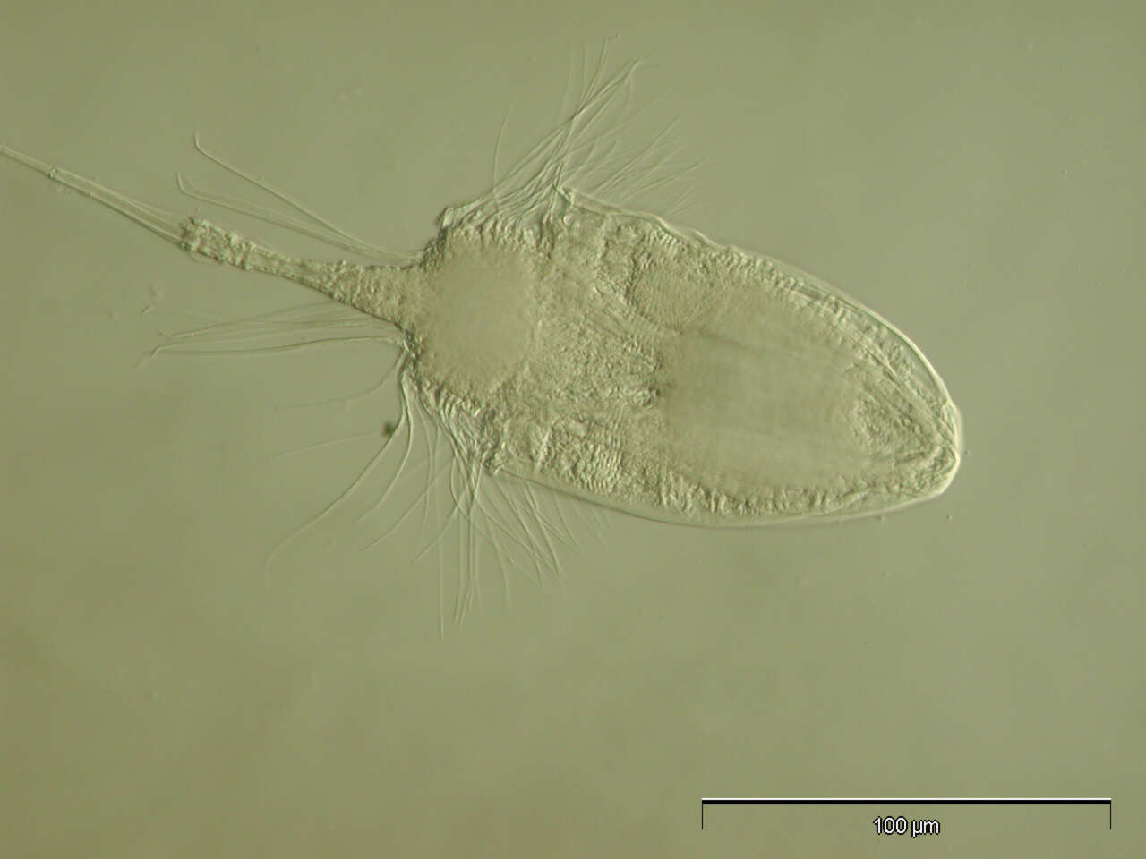 Image of Nanaloricidae