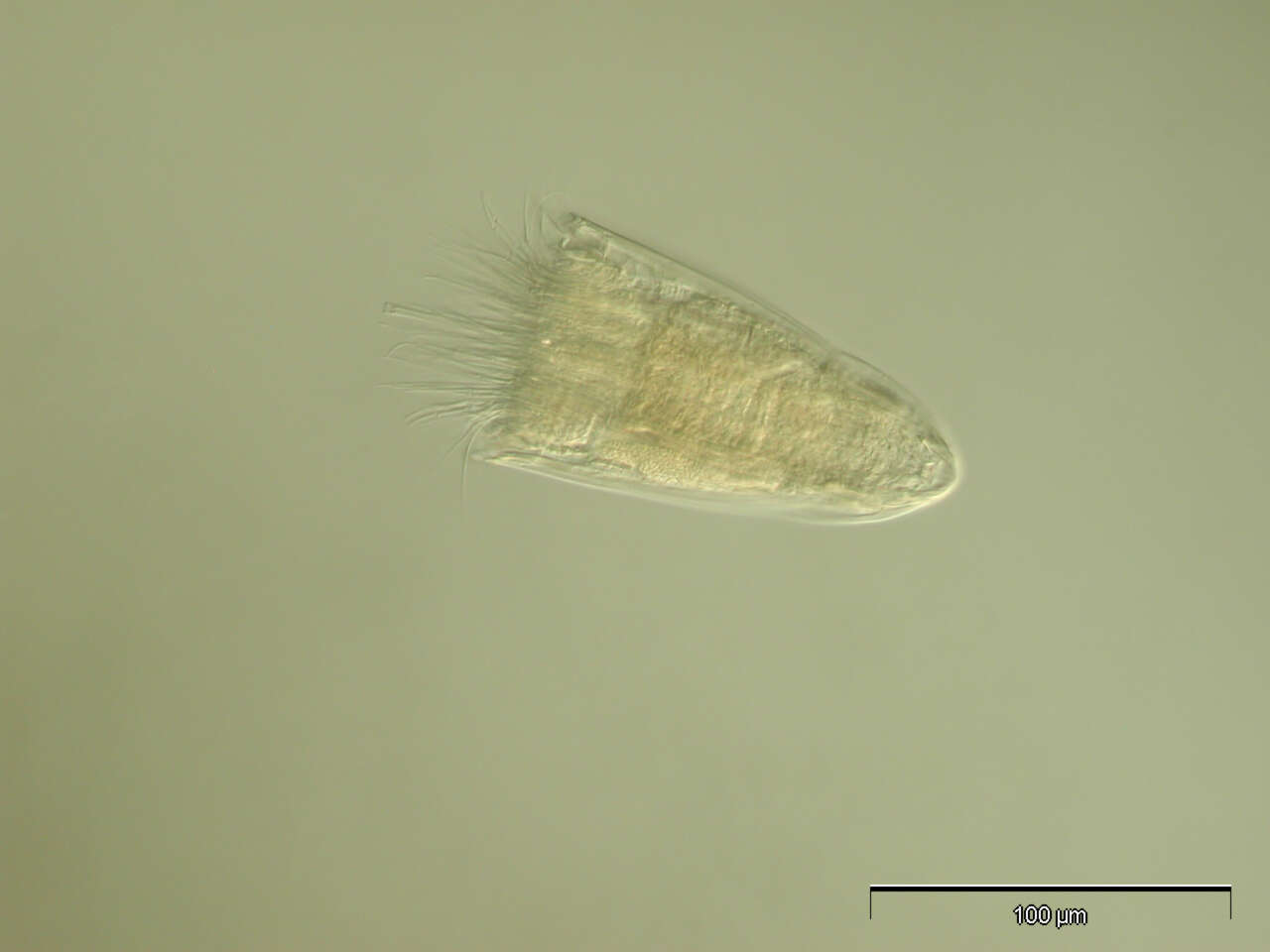 Image of Spinoloricus Heiner & Neuhaus 2007