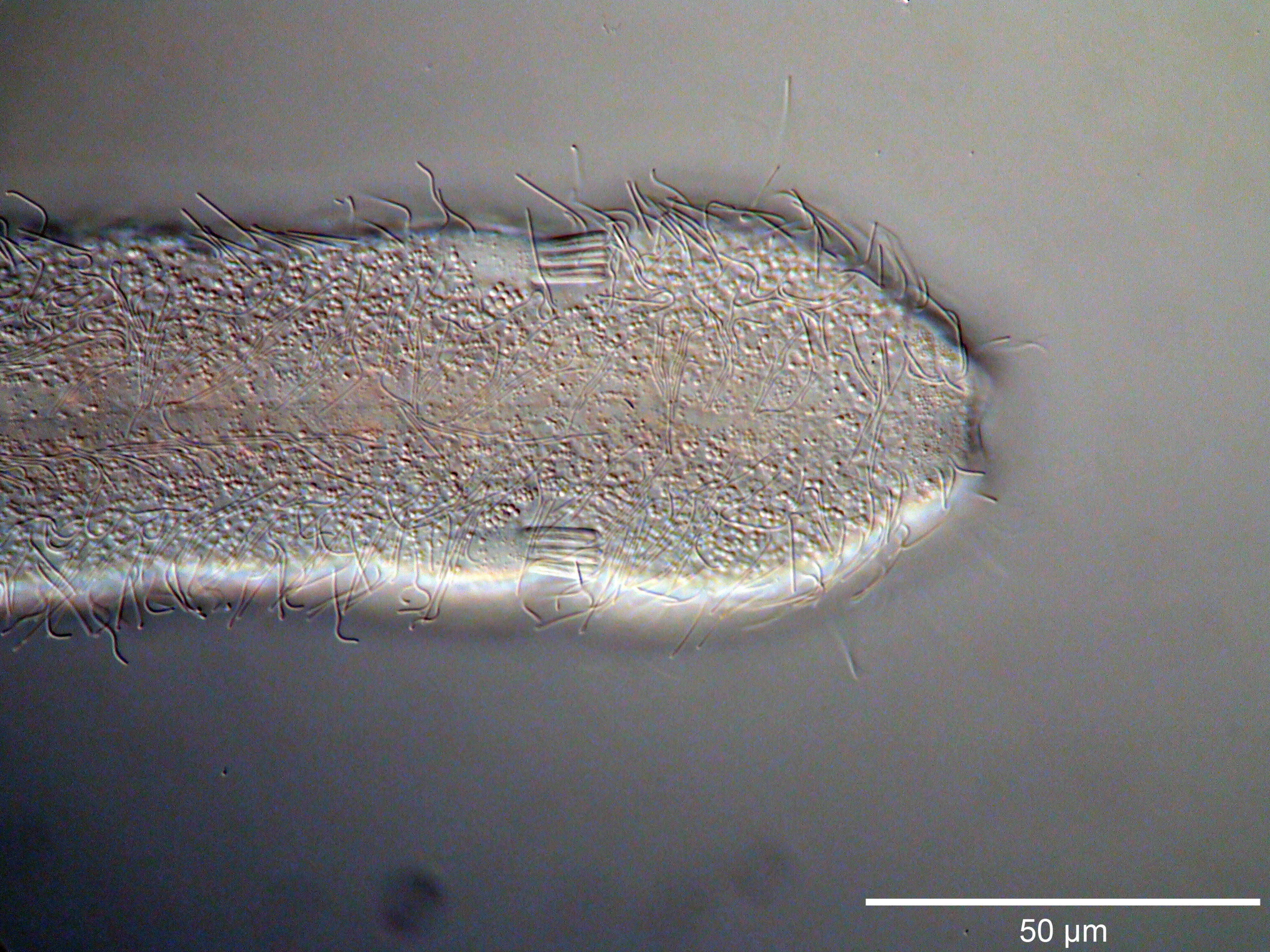 Image of Cephalodasys interinsularis Kieneke, Schmidt-Rhaesa & Hochberg 2015