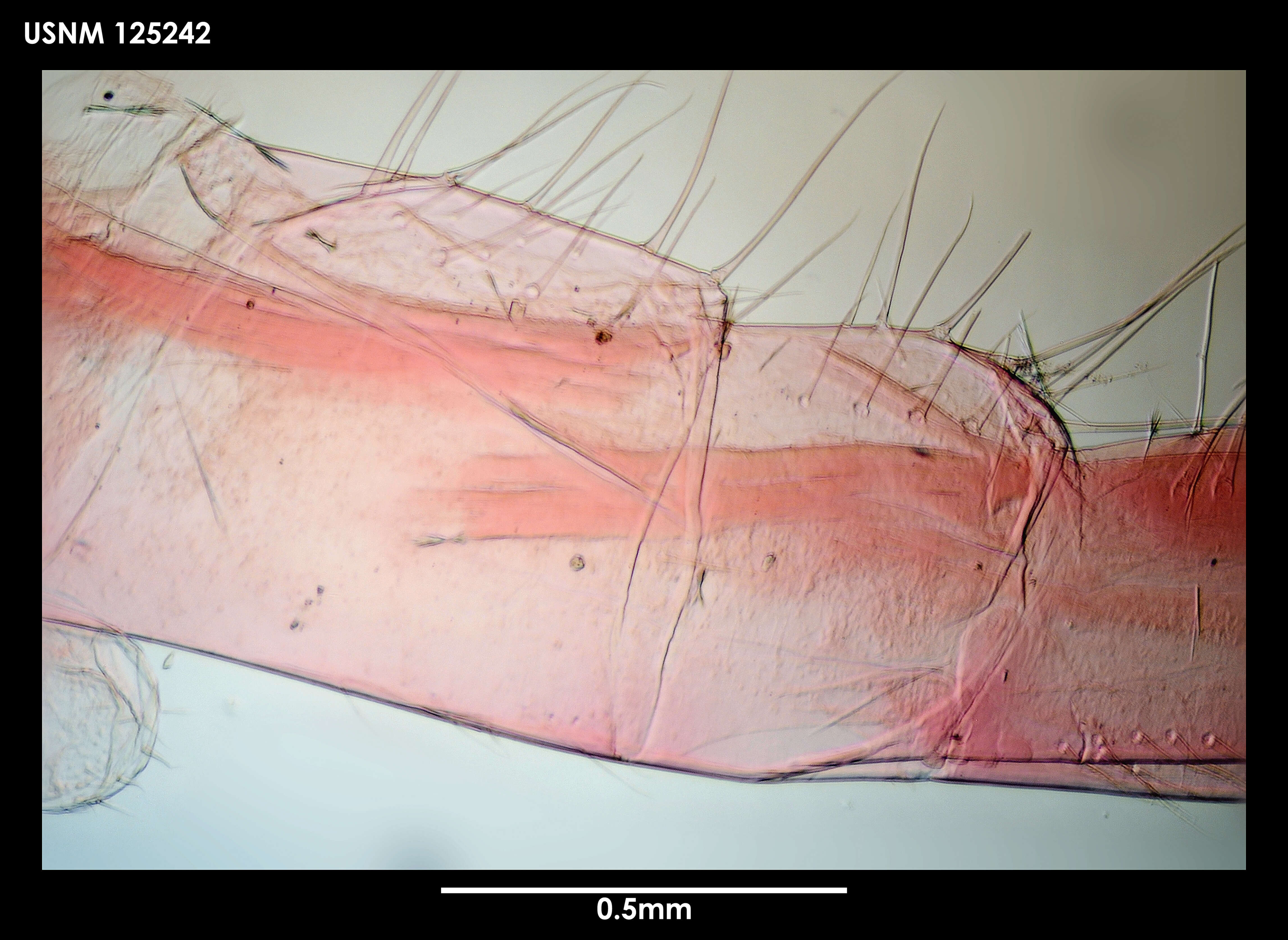 Image of Arcoscalpellum acicularum Newman & Ross 1971