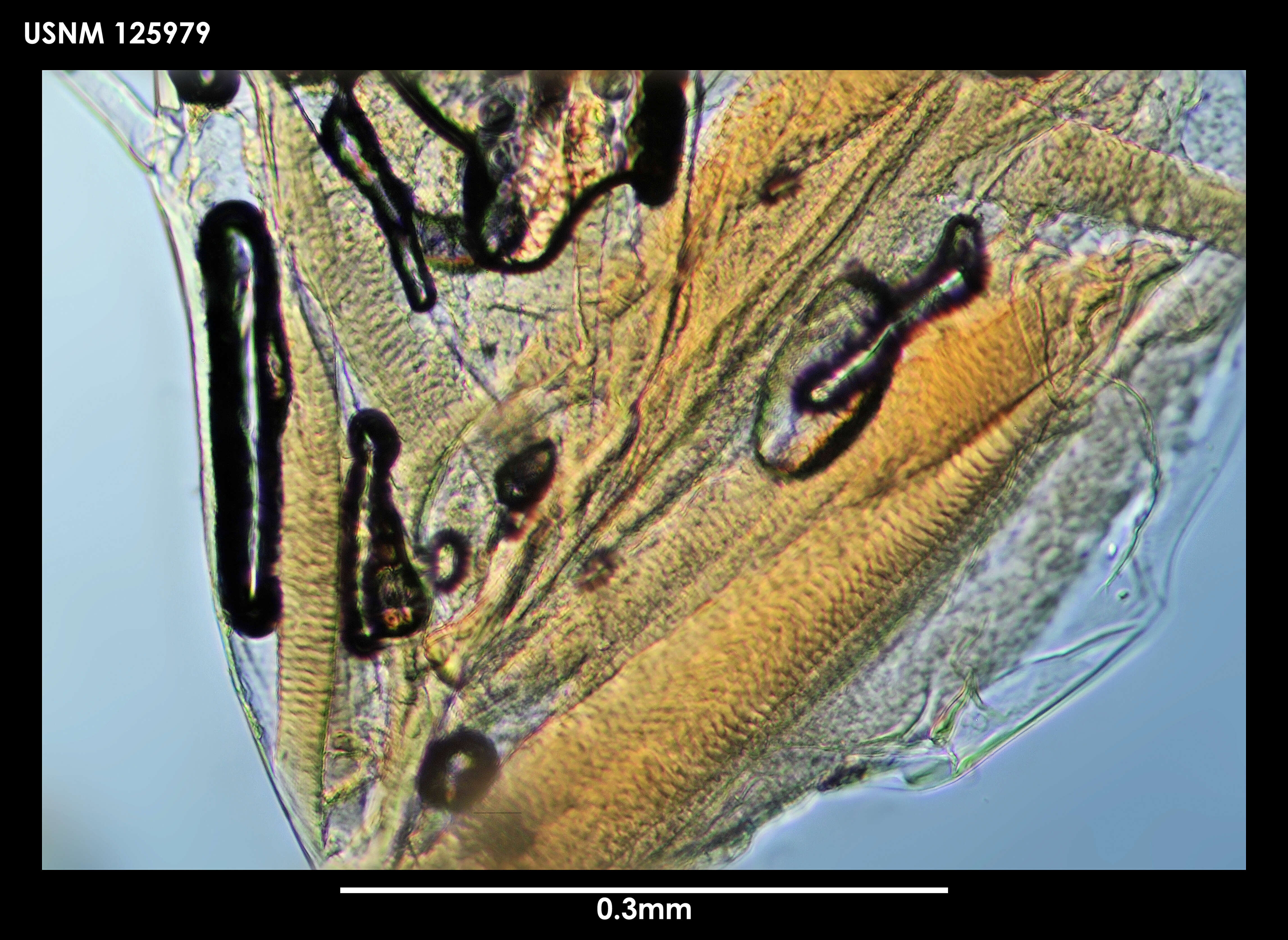 Image of Diasterope schmitti Kornicker 1975