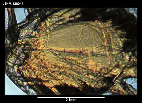 Image de Skogsbergiella macrothrix Kornicker 1975