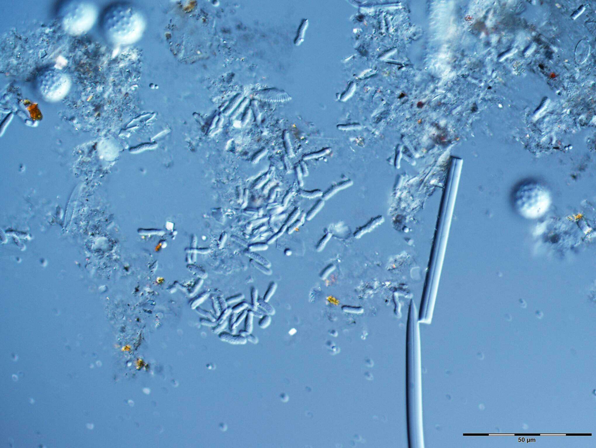 Image of Placospongia intermedia Sollas 1888
