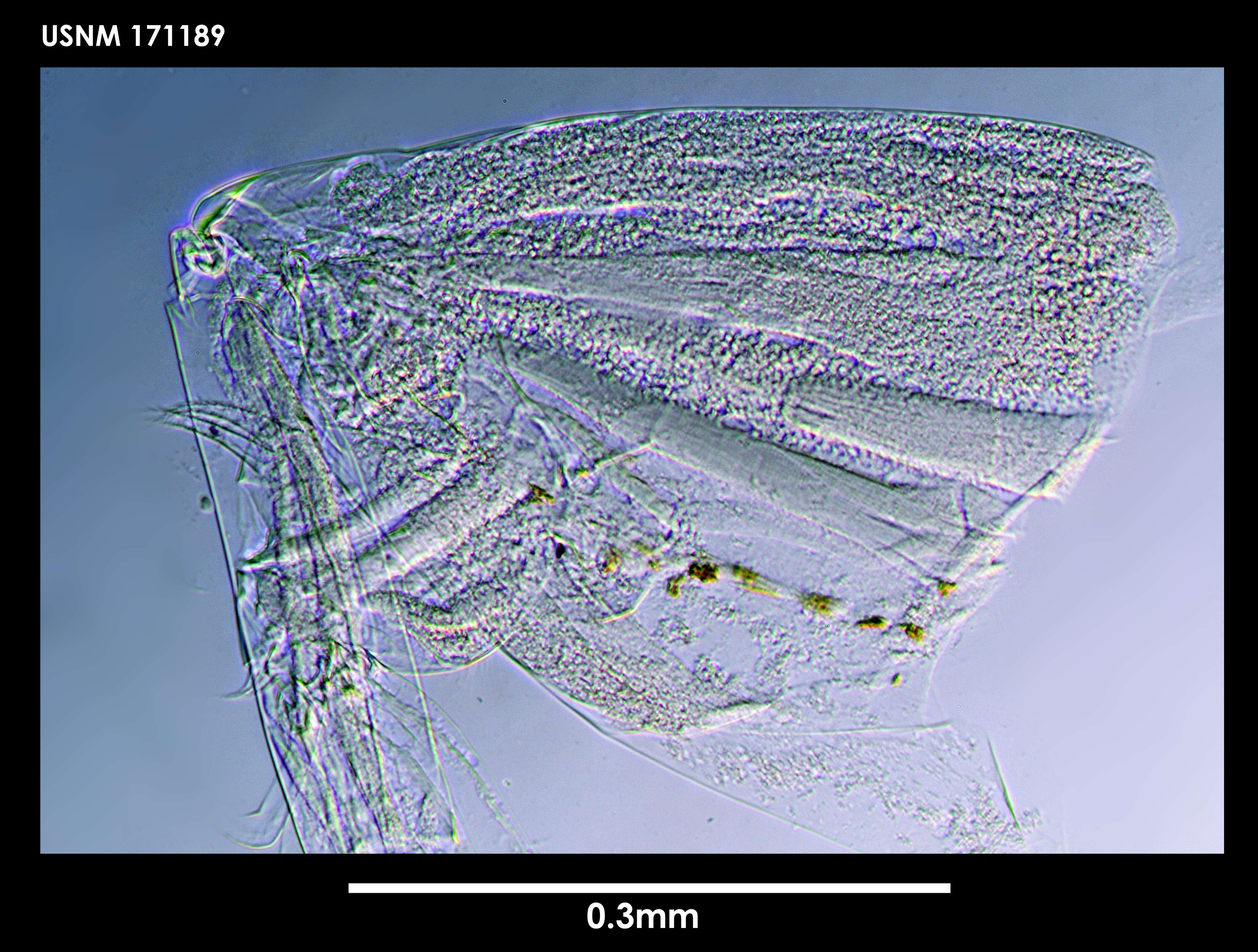 Image of Archiconchoecia bidens Deevey