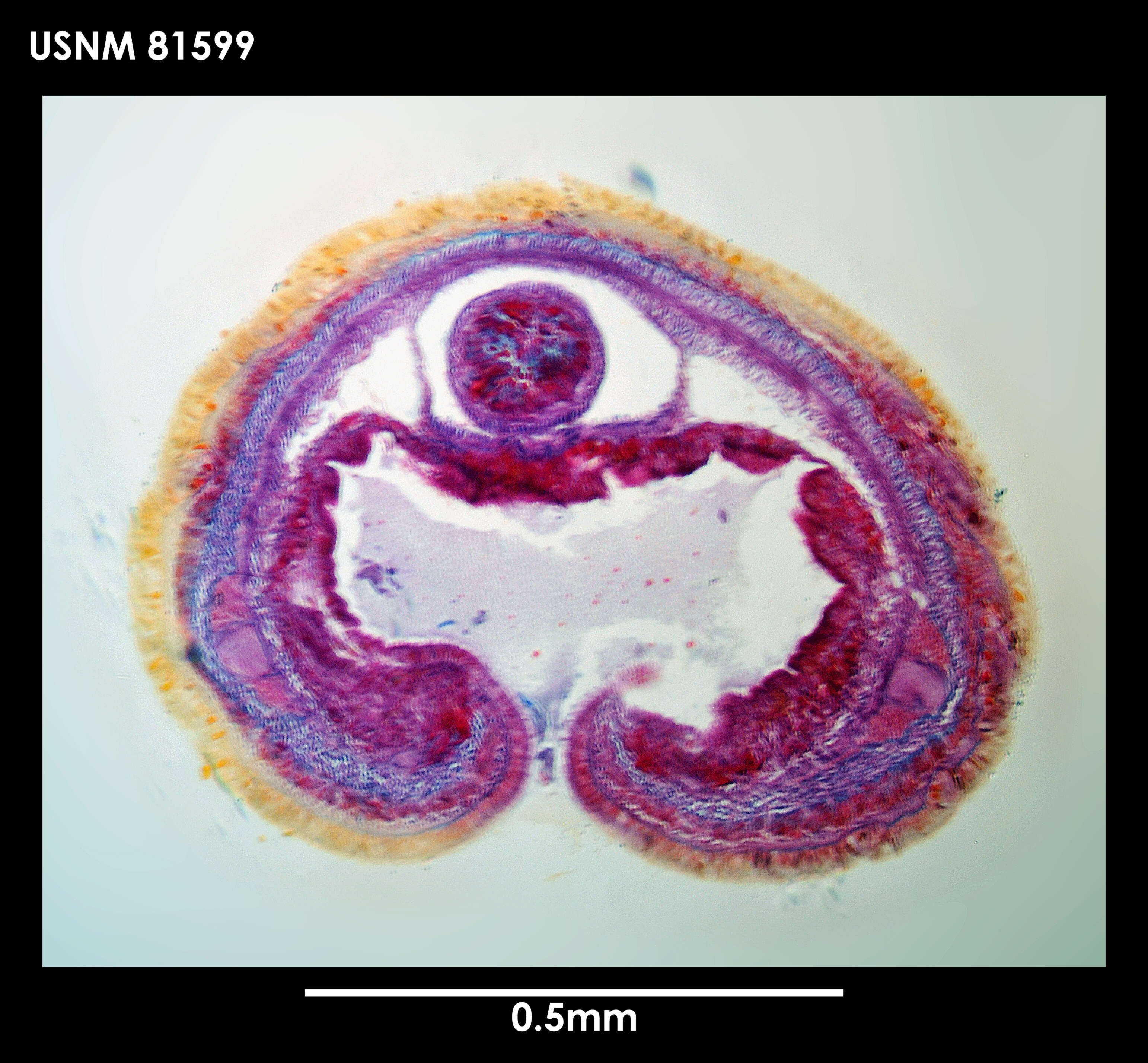 Image of Zodionemertes