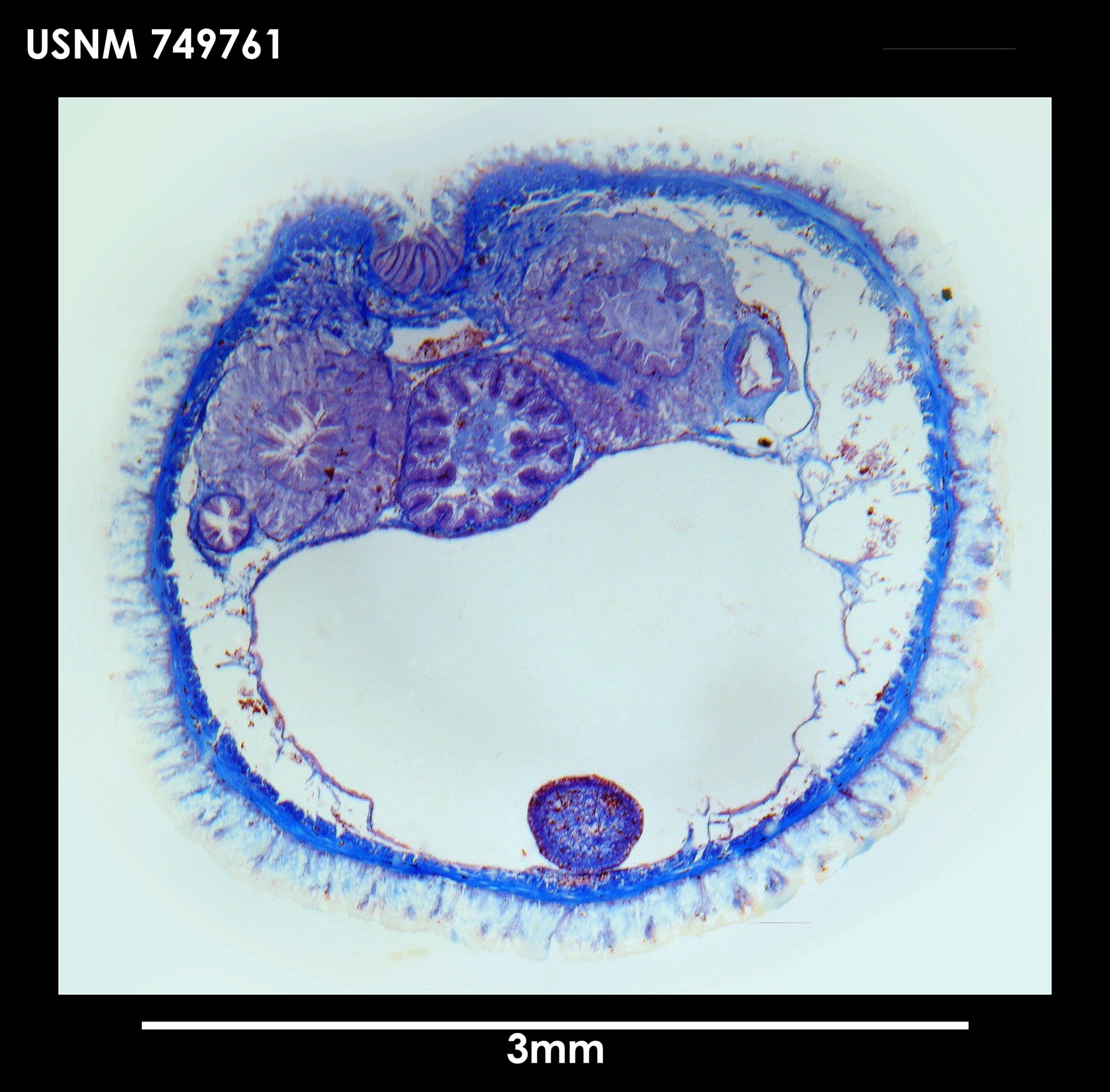 Image of Utralvoherpia abyssalis Salvini-Plawen 1978