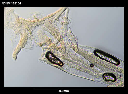 Image of Spinacopia mastix Kornicker 1975