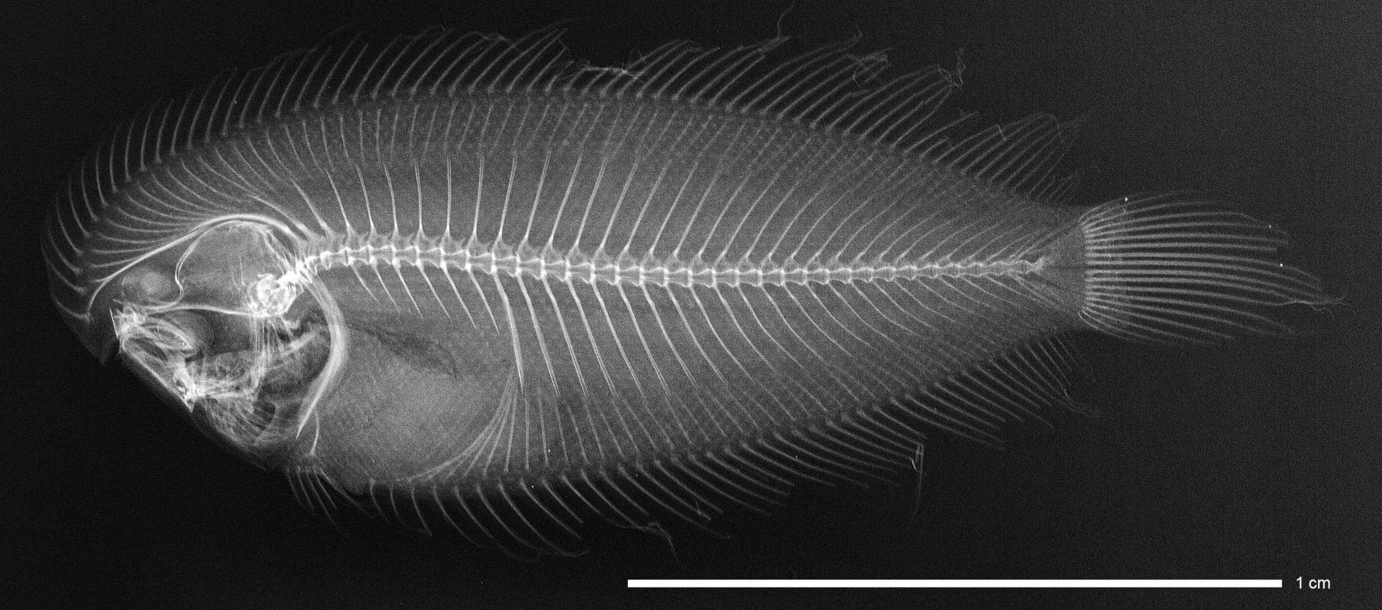 صورة Aseraggodes xenicus (Matsubara & Ochiai 1963)