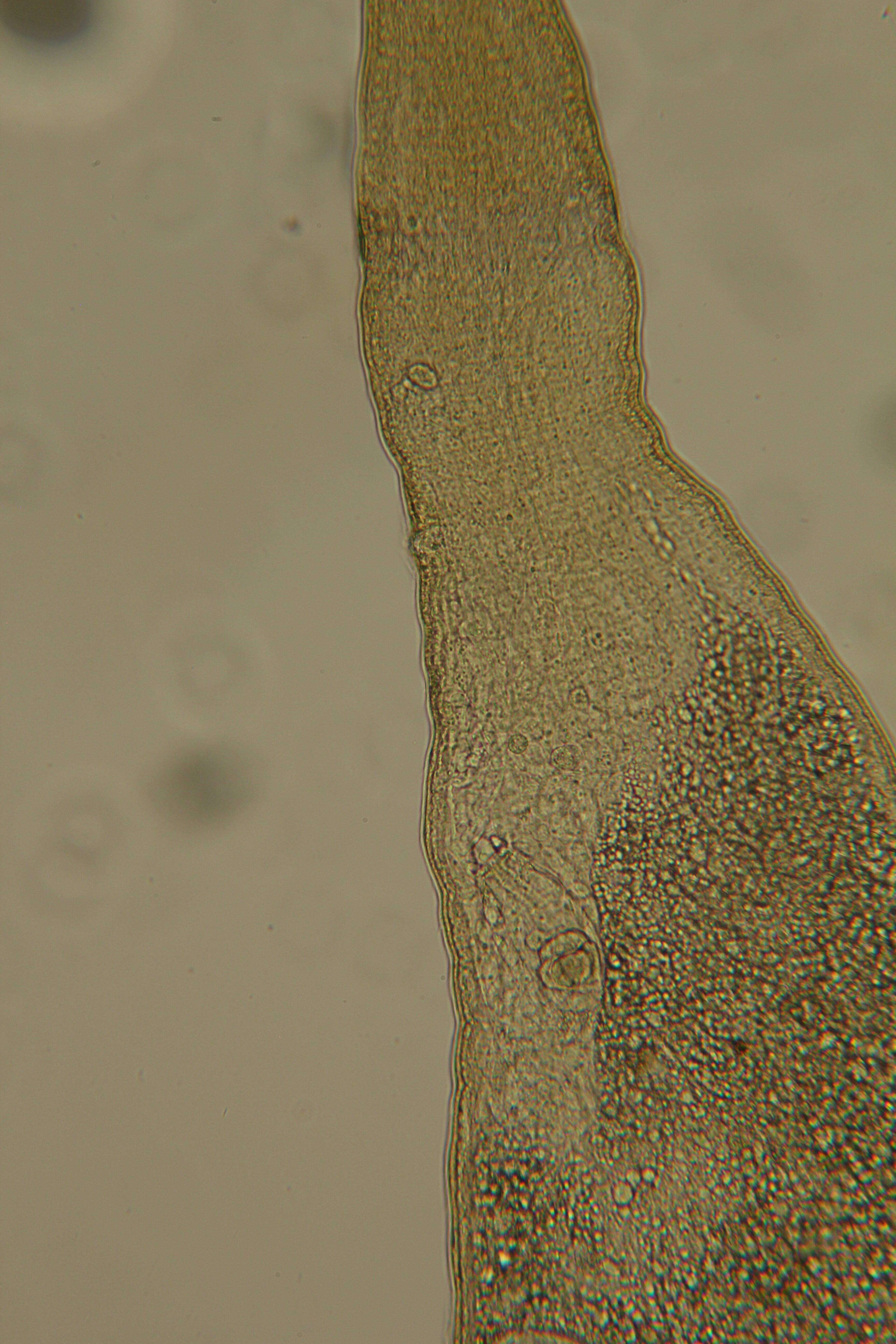 Image of Rhabdocoela