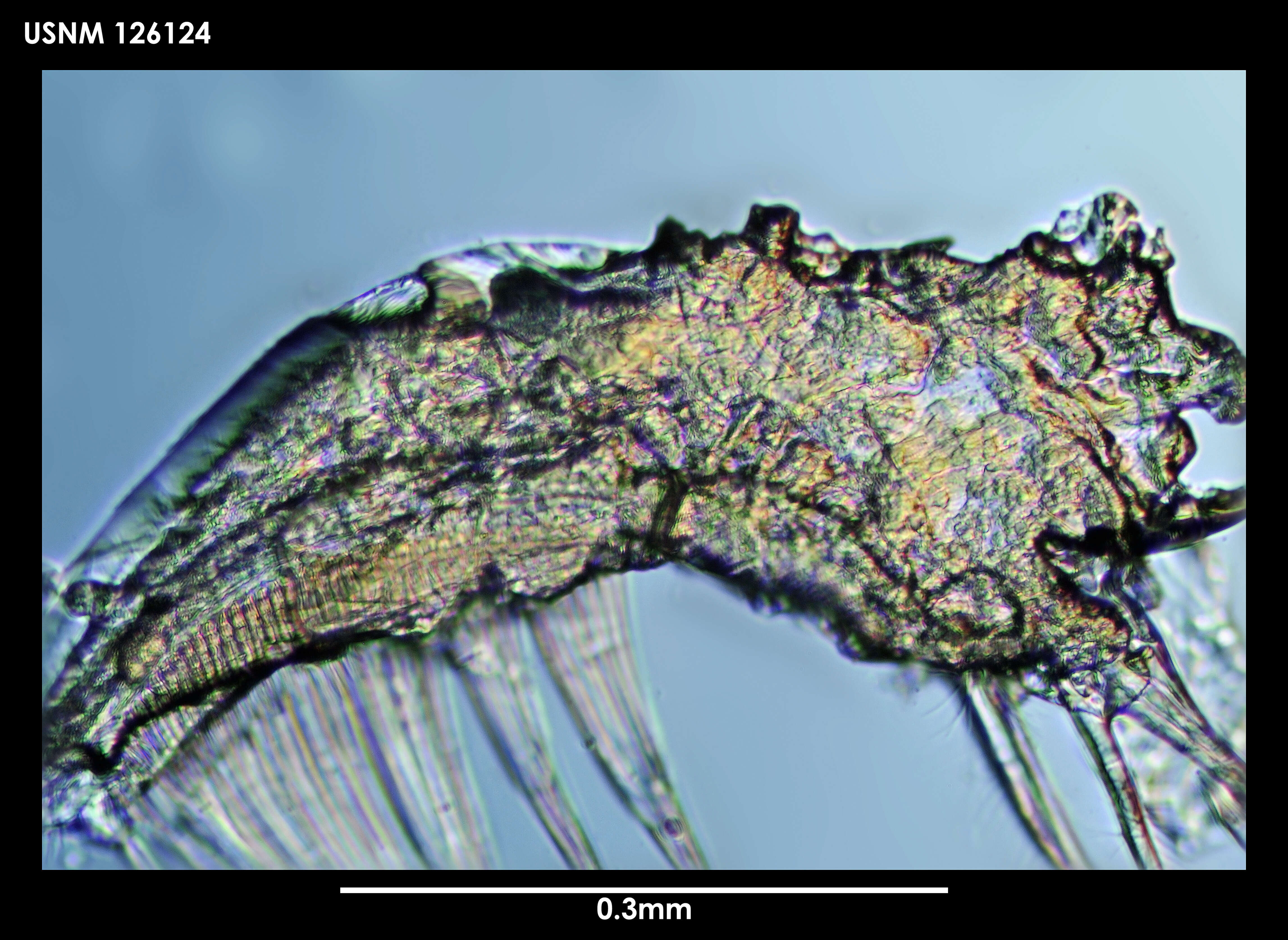 Image de Archasterope antarctica (Kornicker 1975)