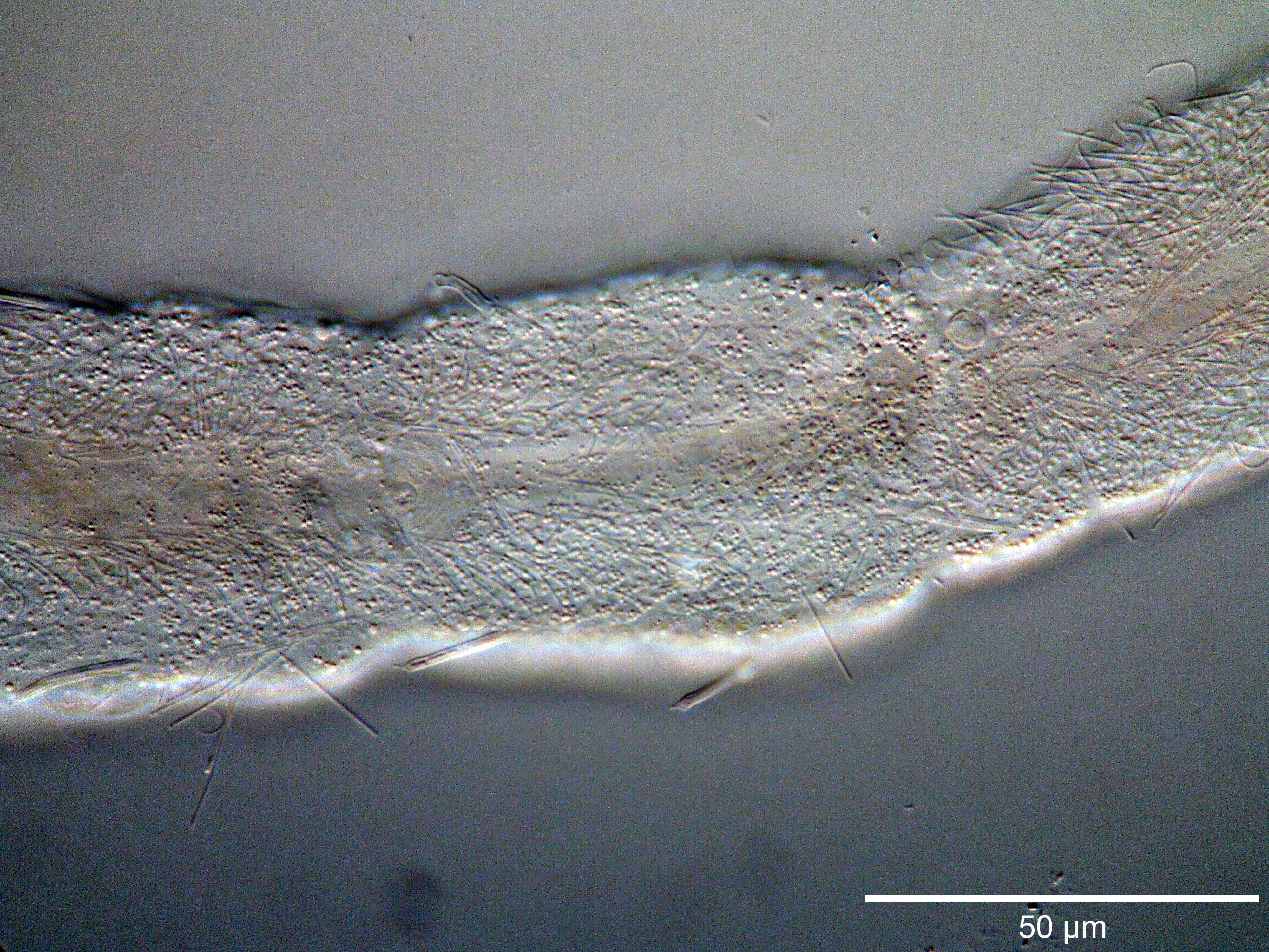 Image of Cephalodasys interinsularis Kieneke, Schmidt-Rhaesa & Hochberg 2015