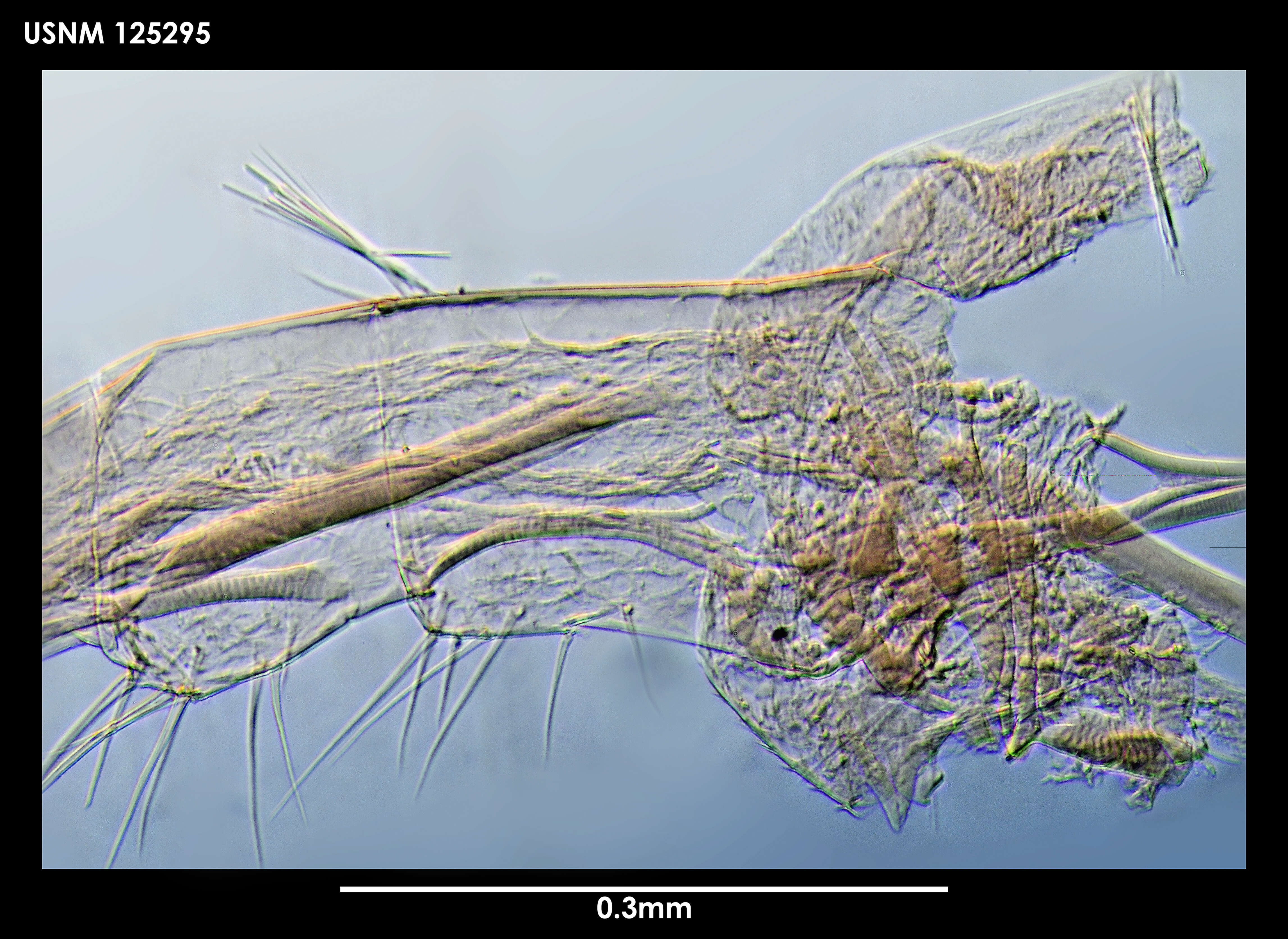 Image of Australscalpellum schizmatoplacinum Newman & Ross 1971