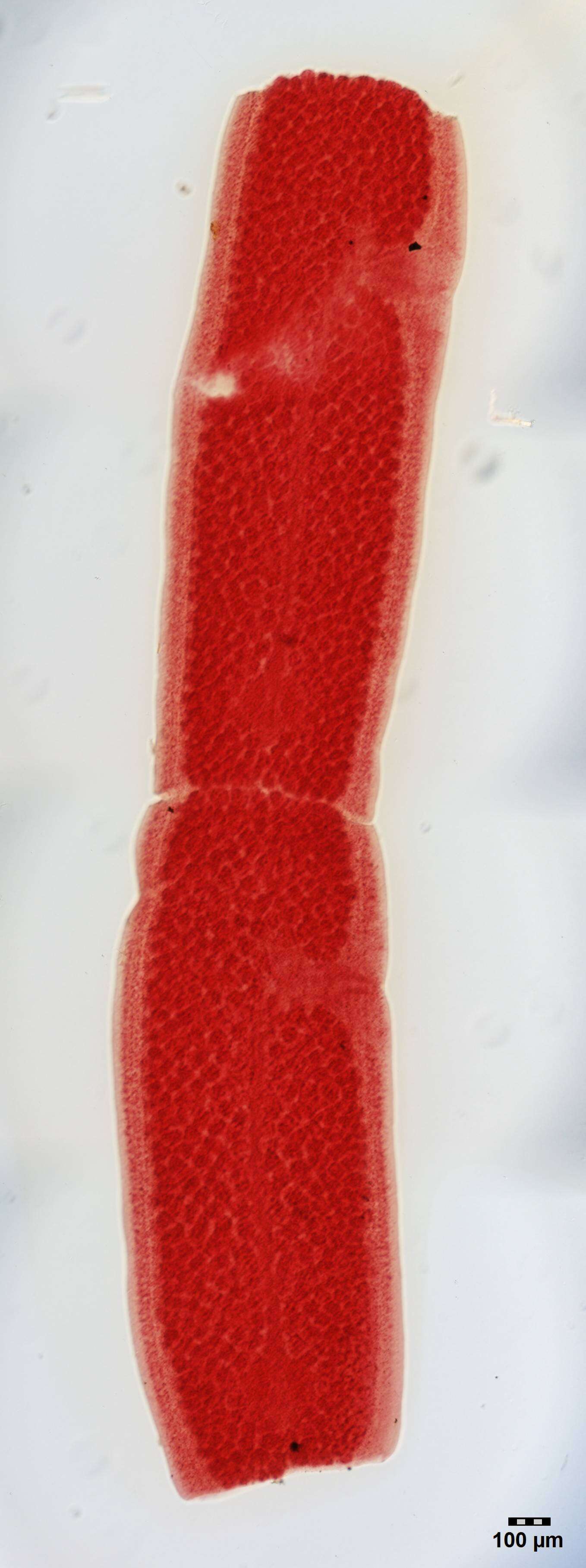 Image of Molicola uncinatus (Linton 1924) Palm 2004
