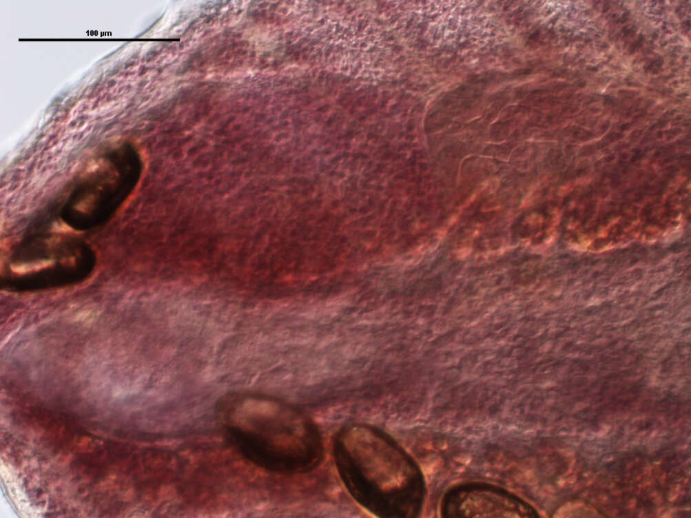 Plancia ëd Lobatostoma ringens (Linton 1905) Eckmann 1932