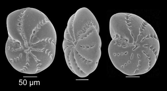 Image of Cribroelphidium excavatum (Terquem 1875)