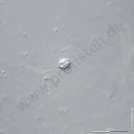 Image of Choanocystis Penard 1904