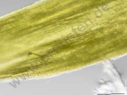 Image of Aphanizomenonaceae