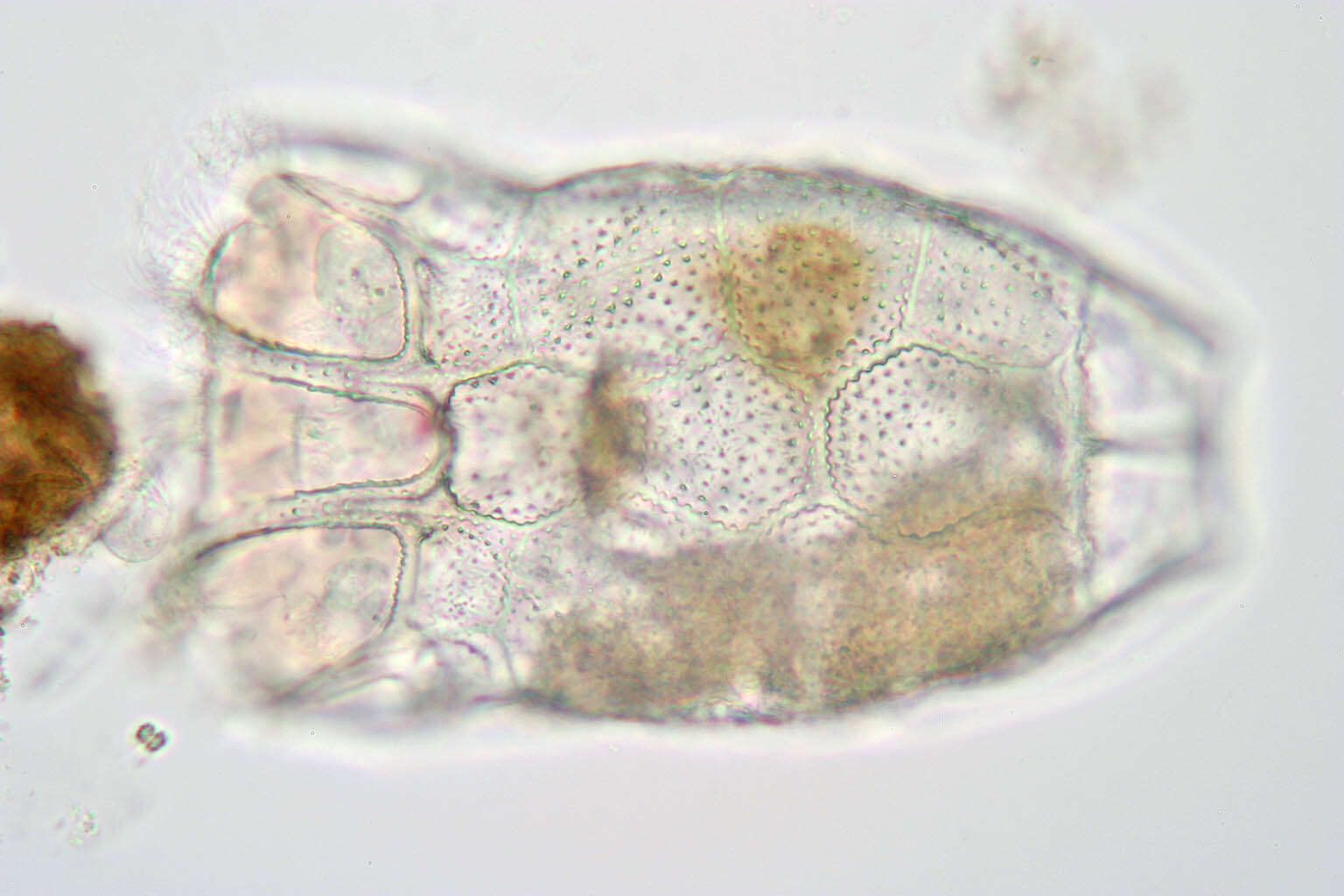 صورة Keratella serrulata (Ehrenberg 1838)