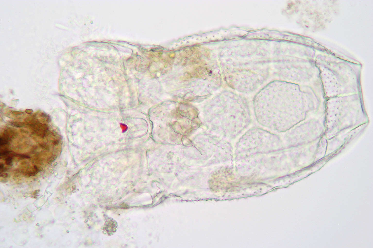 Keratella serrulata (Ehrenberg 1838) resmi