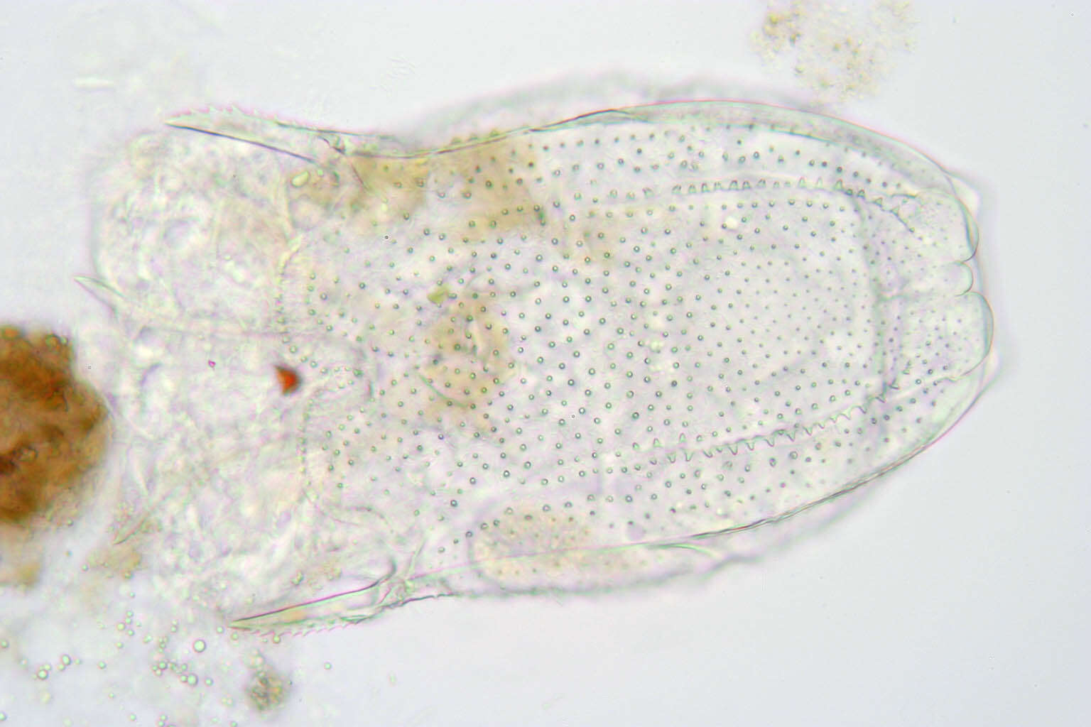 صورة Keratella serrulata (Ehrenberg 1838)