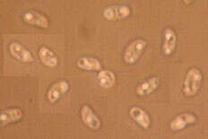 صورة Phlebia livida (Pers.) Bres. 1897