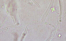 صورة Phlebia livida (Pers.) Bres. 1897