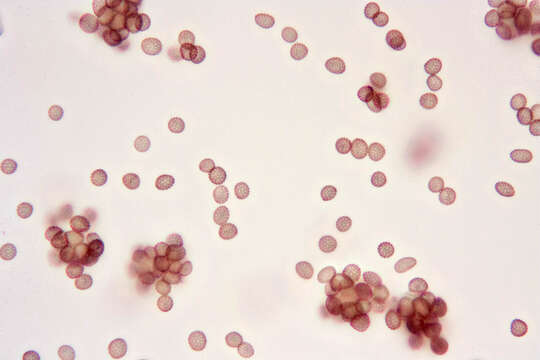 صورة Microbotryum major (J. Schröt.) G. Deml & Oberw. 1982