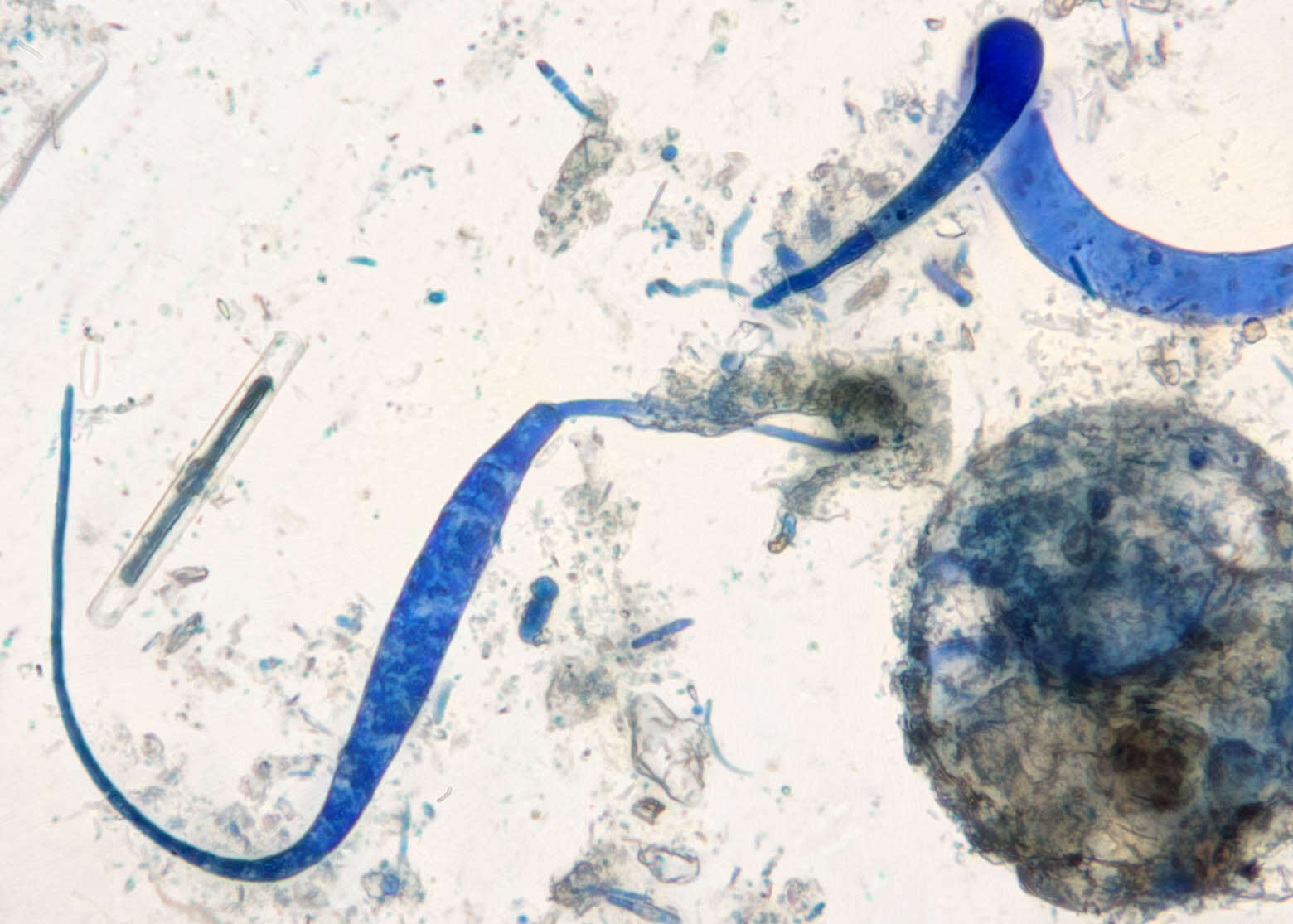 Image of Mycocentrospora acerina (R. Hartig) Deighton 1972