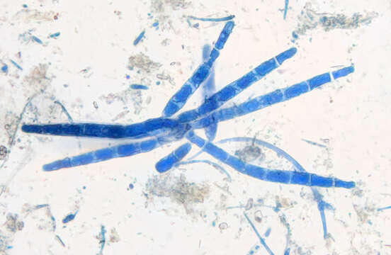 صورة Dendrospora