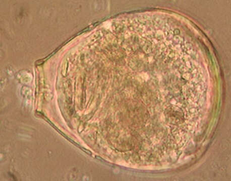 Image of Hyalosphenia